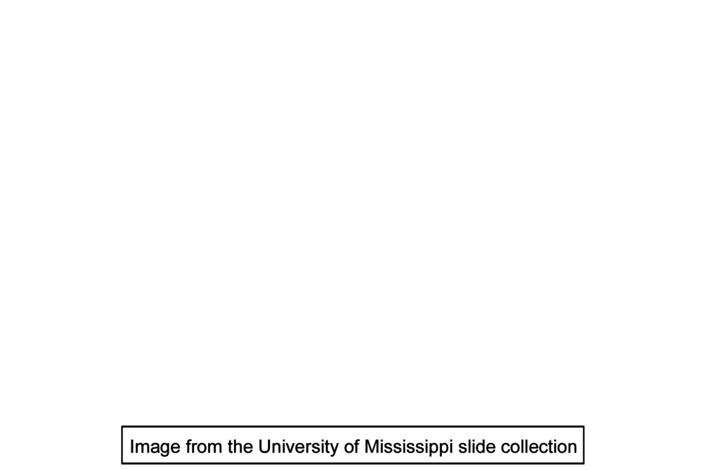 Image source > <p>Image taken of slide in the University of Mississippi collection.</p>
