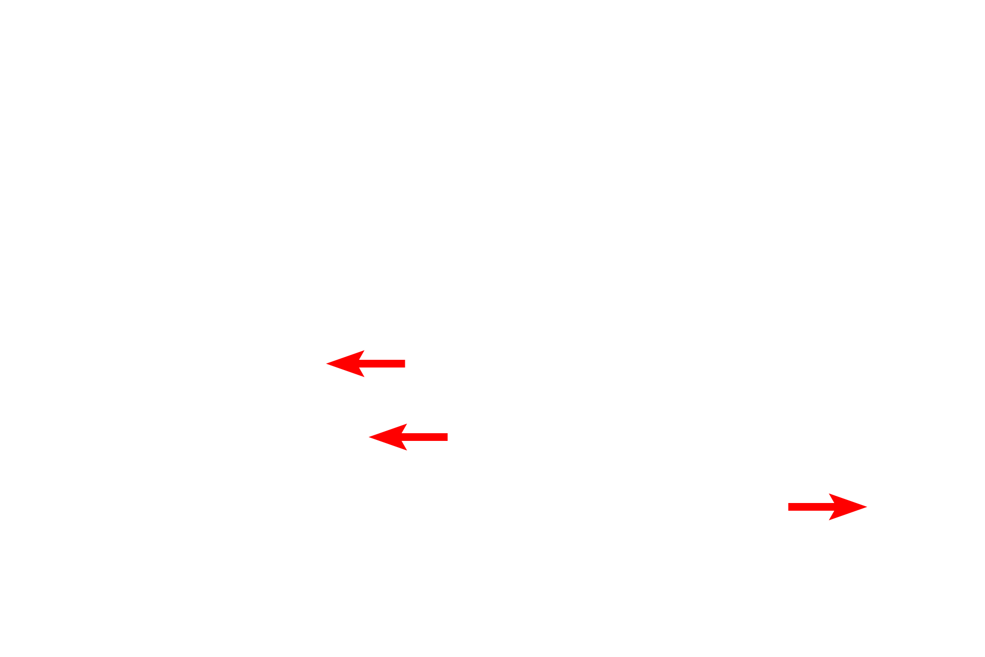  - Fenestrations and discontinuities <p>Sinusoids, discontinuous capillaries, are lined by a fenestrated endothelium with additional gaps between adjacent cells.  The discontinuous basal lamina allows easy access between the sinusoid and the space of Disse, located between sinusoids and adjacent hepatocytes.  Kupffer cells (liver macrophages) span sinusoids, phagocytosing aged erythrocytes and debris.  5000x</p>
