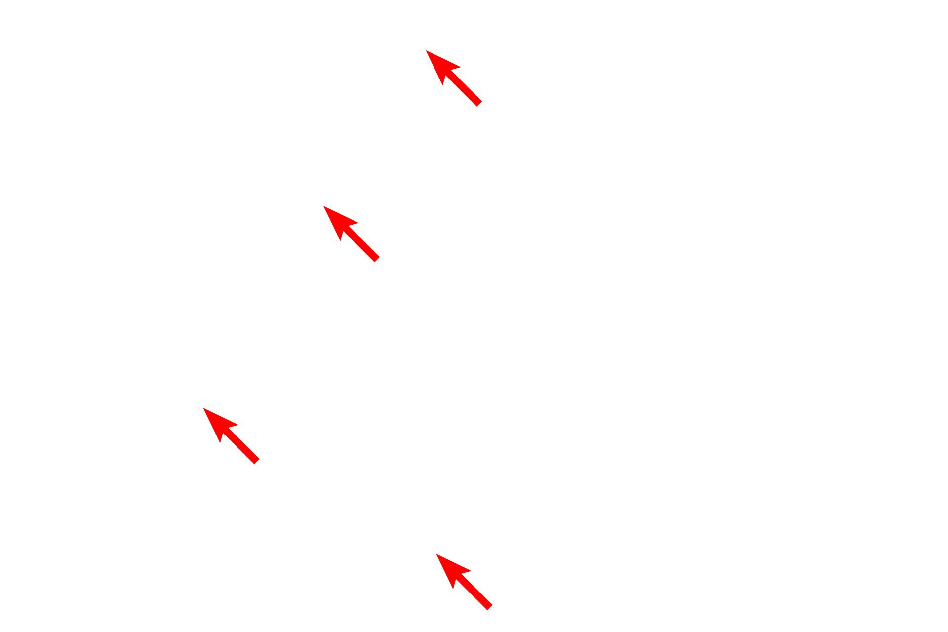  - Glycogen <p>Sinusoids, discontinuous capillaries, are lined by a fenestrated endothelium with additional gaps between adjacent cells.  The discontinuous basal lamina allows easy access between the sinusoid and the space of Disse, located between sinusoids and adjacent hepatocytes.  Kupffer cells (liver macrophages) span sinusoids, phagocytosing aged erythrocytes and debris.  5000x</p>
