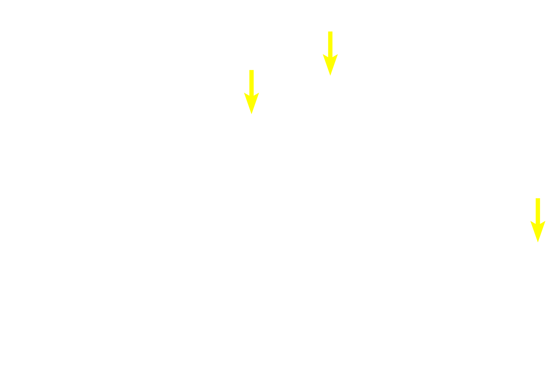  - Acinar lumens <p>Serous secretions are released into the lumen of the acinus and continue into the smaller of the intralobular ducts, the intercalated ducts.  Intercalated ducts are initially lined by simple squamous epithelium which quickly becomes simple cuboidal.  Intercalated ducts are smaller in diameter than the acini.  The point where two acini empty into an intercalated duct is visible in this image.  600x</p>
