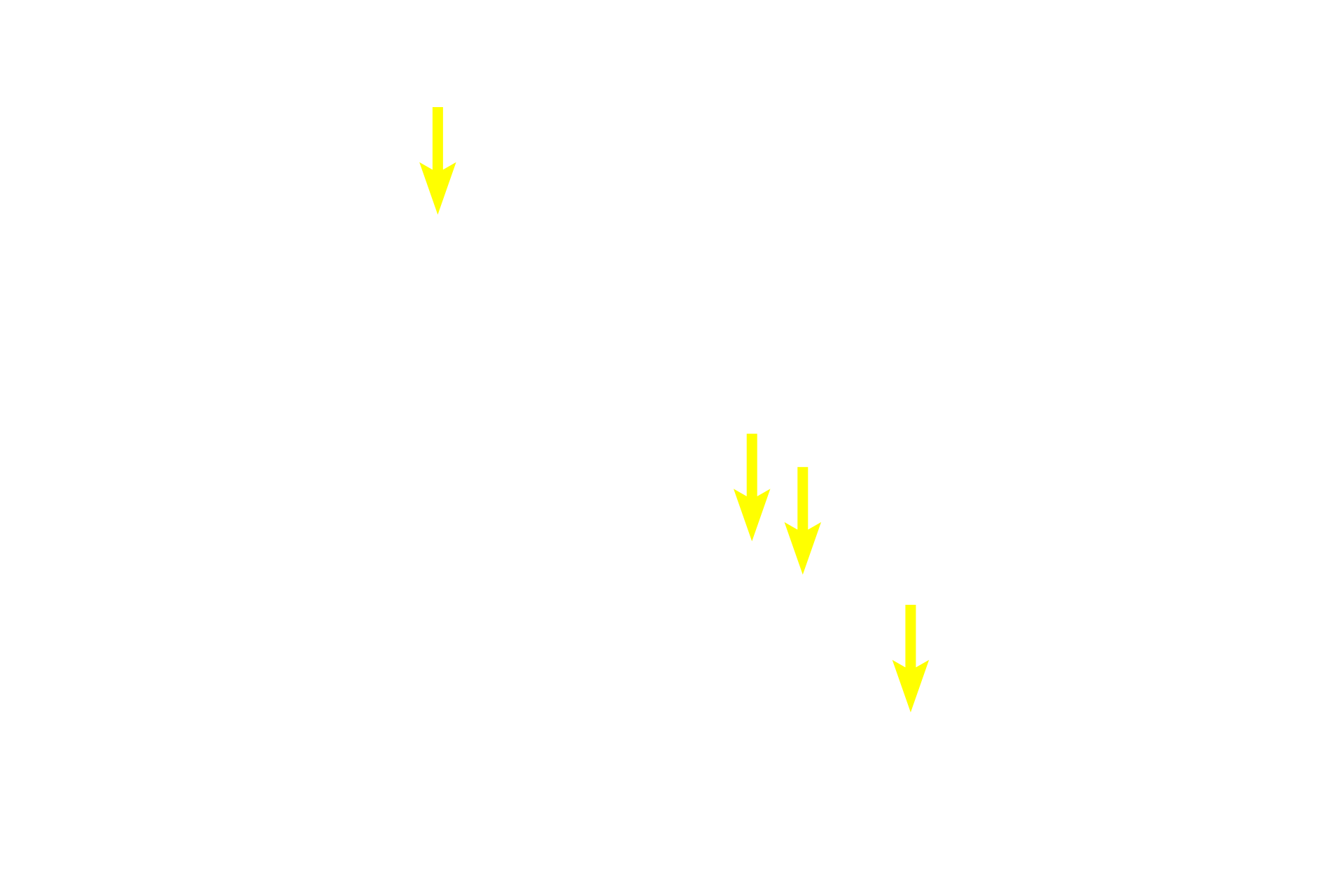 Secretory product <p>The lining cells of Intercalated ducts add bicarbonate to the secretory product and absorb chloride ions from it.  Because it is composed entirely of acini, the parotid has more numerous ducts than the other salivary glands.</p>
