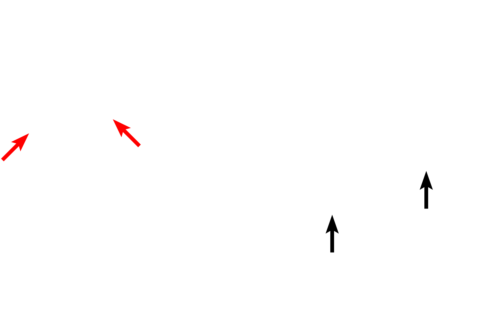 Serosa > <p>The outermost layer of the large intestine is either an adventitia or a serosa, depending on whether a particular segment of this organ is intra- or retroperitoneal in location.</p>
