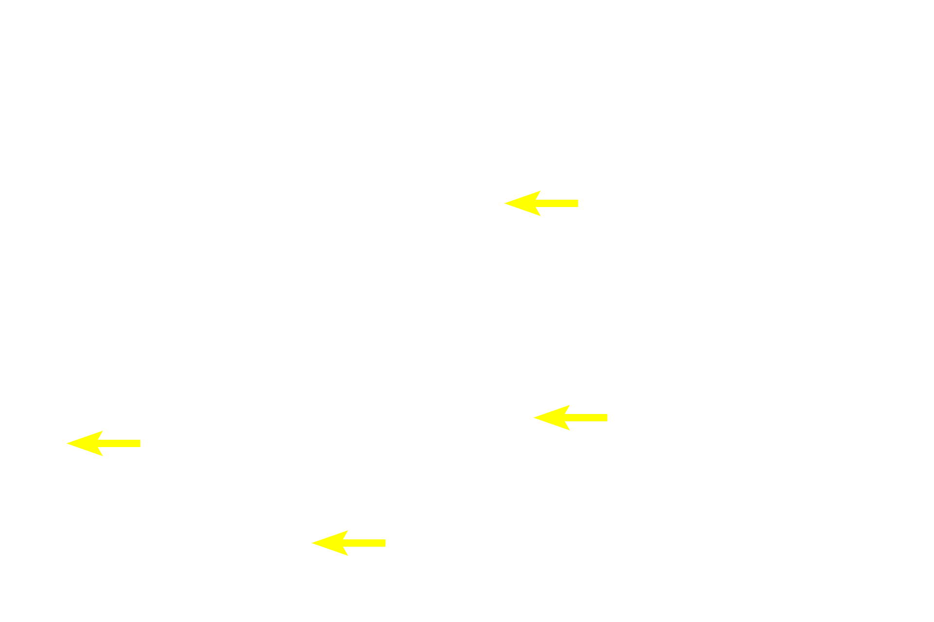  - Lamina propria <p>The mucosa of the large intestine is lined by absorptive and goblet cells forming a simple columnar epithelium with microvilli.   Goblet cells increase in number from the beginning to the termination of the large intestine, providing lubrication.  A reduced number of enteroendocrine cells is present.  Straight intestinal glands are typical of the large intestine.  400x</p>
