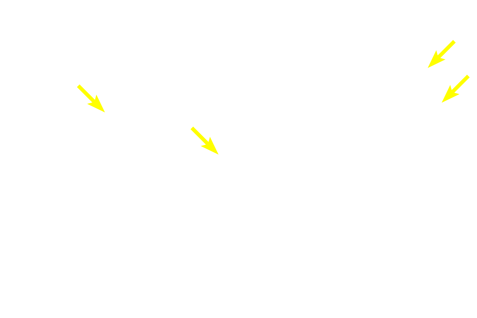  - Goblet cells <p>The mucosa of the large intestine is lined by absorptive and goblet cells forming a simple columnar epithelium with microvilli.   Goblet cells increase in number from the beginning to the termination of the large intestine, providing lubrication.  A reduced number of enteroendocrine cells is present.  Straight intestinal glands are typical of the large intestine.  400x</p>
