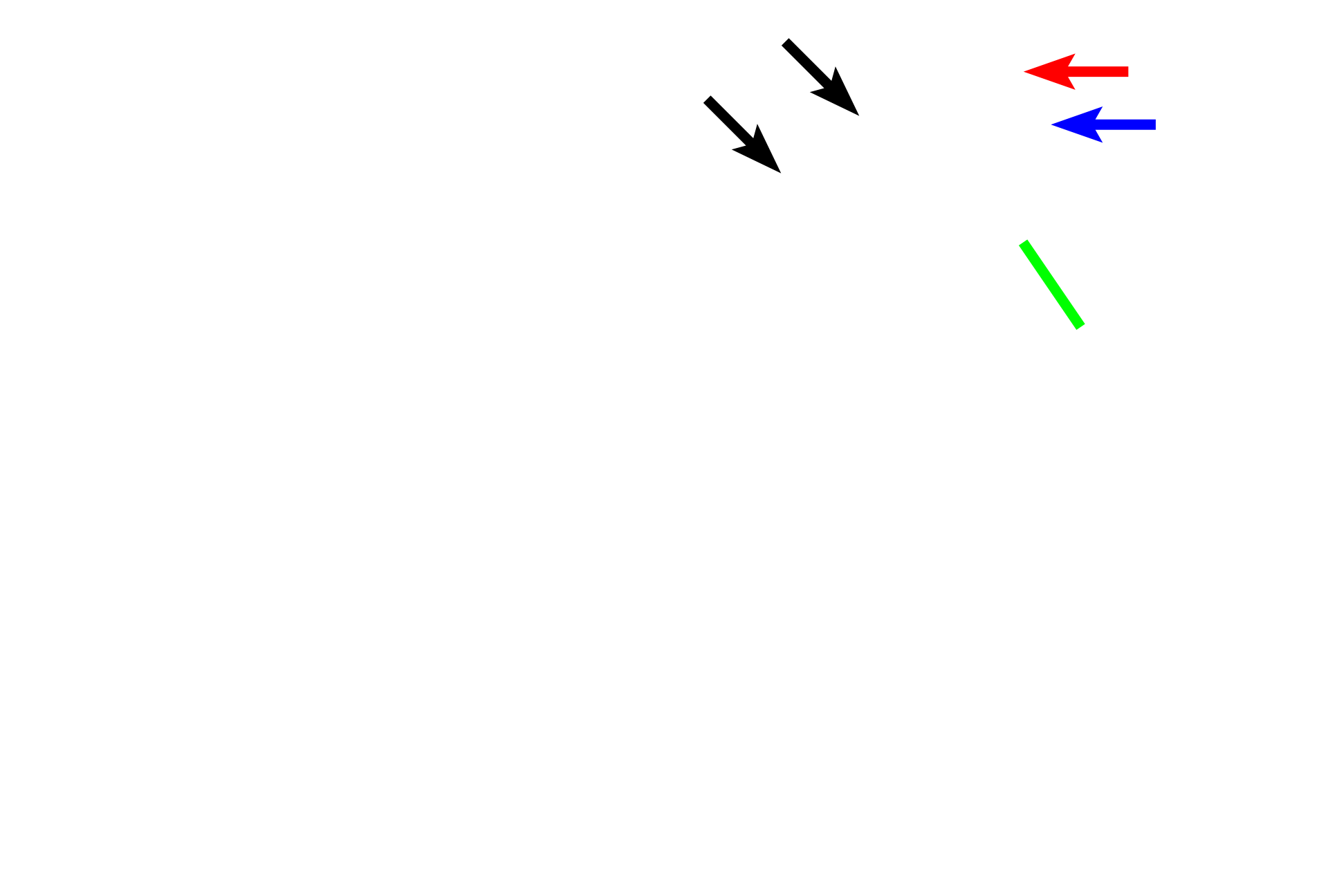 Stomach > <p>The stomach is characterized by a thick mucosa lined by a surface sheet gland (black arrows).  The lamina propria is filled with gastric glands (blue arrow), each opening into a gastric pit (red arrow).  The muscularis externa (green line) is very thick with three, rather than the usual two, subdivisions.  The stomach is covered by a serosa.</p>
