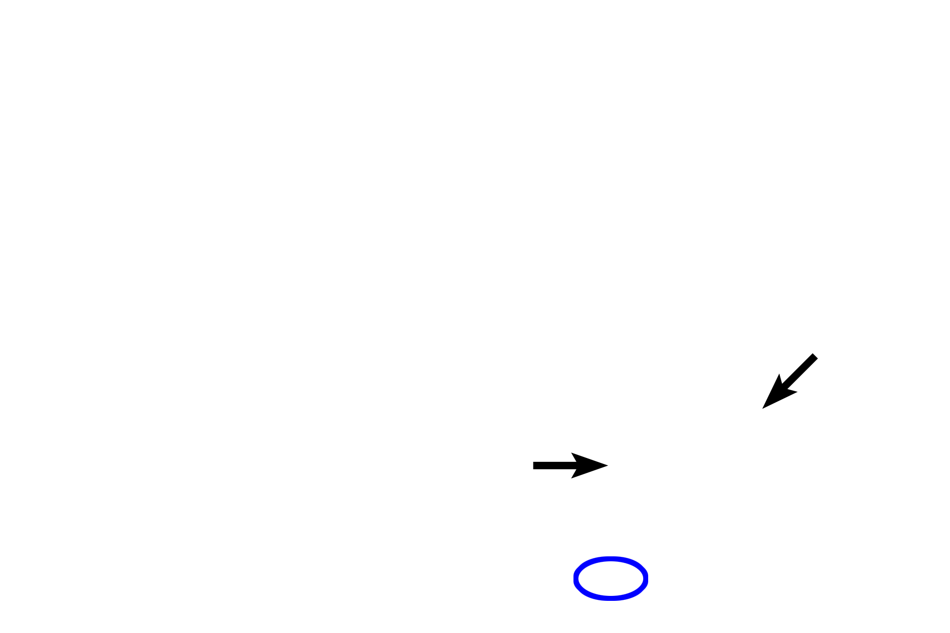 Large intestine > <p>The large intestine lacks villi and possesses very straight intestinal glands (black arrows) in lamina propria.  No submucosal glands are present.  Most of the outer longitudinal subdivision of muscularis externa is relegated to three longitudinal strips termed the taeniae coli (oval).  The large intestine is covered by either an adventitia or a serosa, depending on its location.</p>
