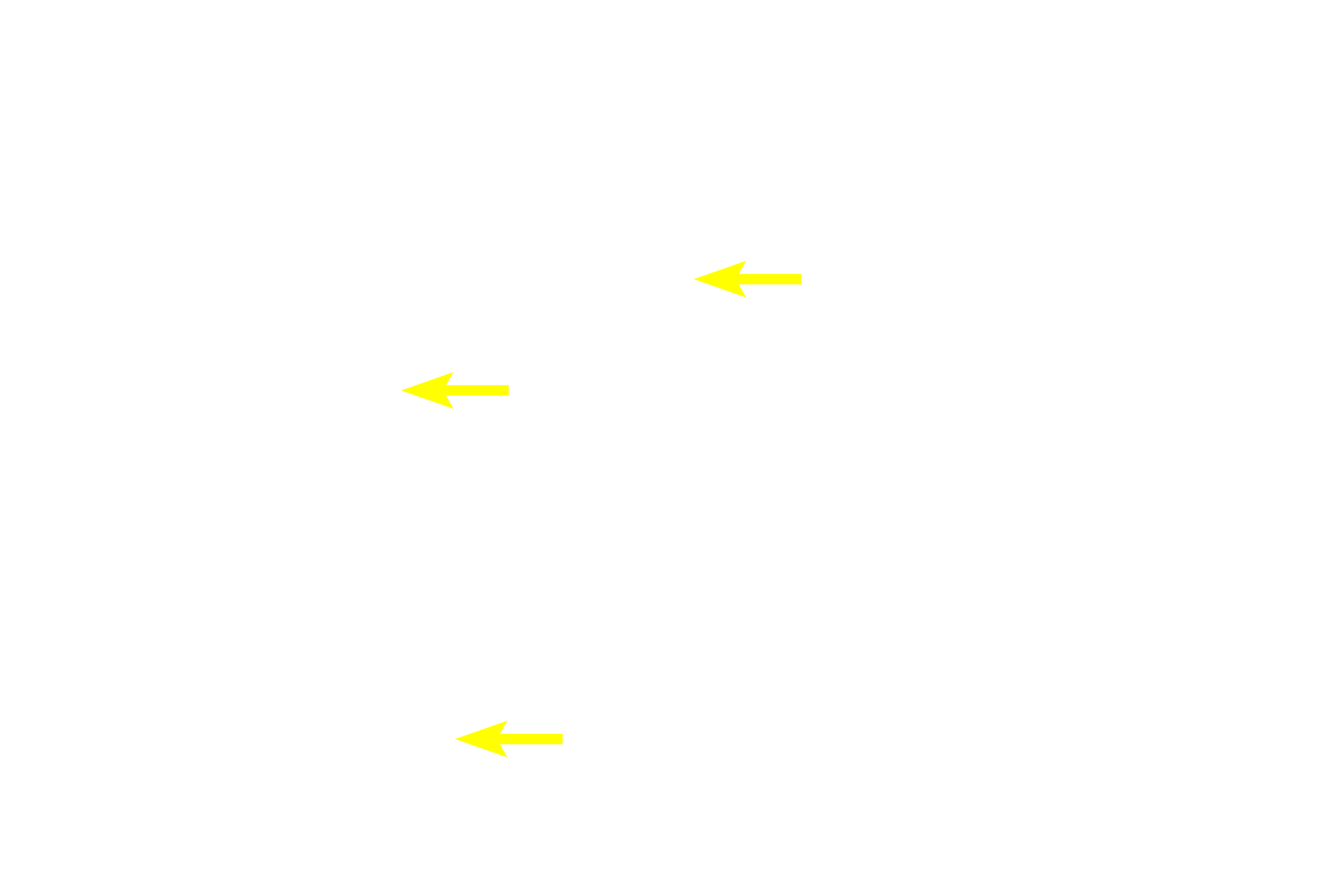  - Enterocytes <p>The small intestine is lined by a simple columnar epithelium of absorptive cells (enterocytes) with microvilli and goblet cells.  Microvilli, which form a brush border on the apical surface of the absorptive cells are shown in greater detail in the electron micrograph.  1000x, 10,000x</p>
