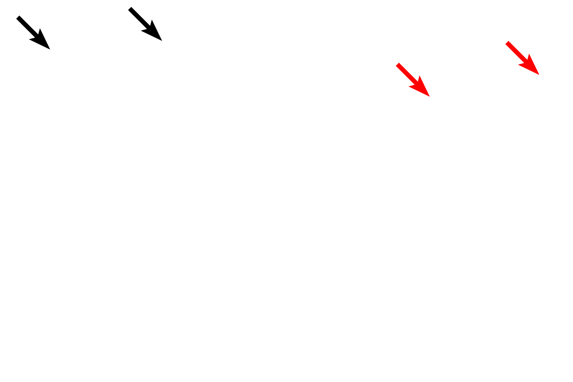  - Microvilli > <p>The luminal surfaces of enterocytes are covered by microvilli that greatly increase the surface area for absorption.  Collectively, these microvilli form a brush border.</p>
