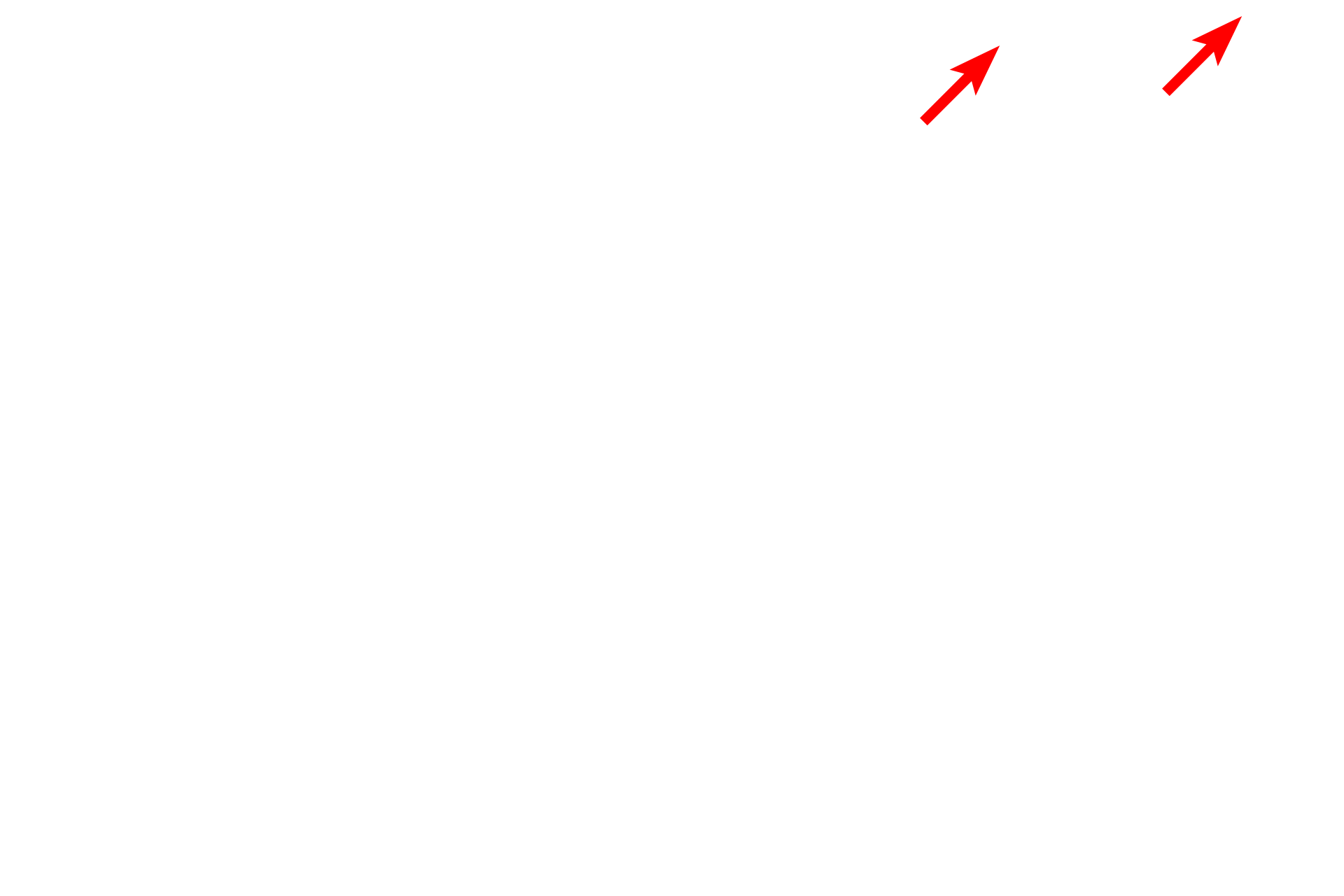  - Glycocalyx > <p>Extending from the microvilli is the glycocalyx, consisting of highly branched carbohydrate molecules that sequester enzymes important in digestion and in the transport of nutrients.  The glycocalyx also aids in retention of the bacterial flora present in the intestinal lumen.</p>
