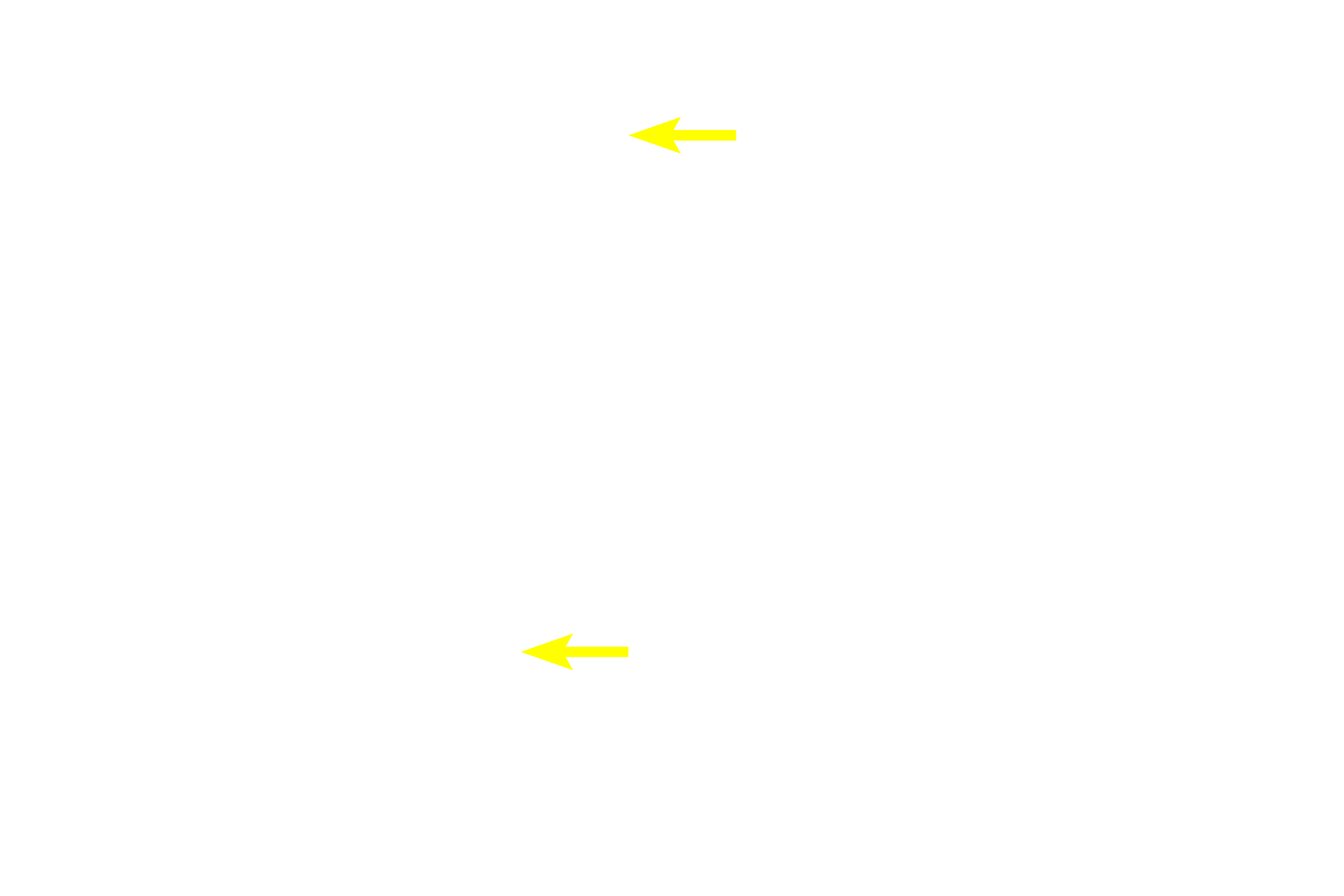  - Paneth cells > <p>Paneth cells have prominent, eosinophilic granules that face the lumens of the glands.  They produce lysozyme, an enzyme that digests bacterial cell walls, and also probably aids in maintenance of healthy intestinal flora.</p>
