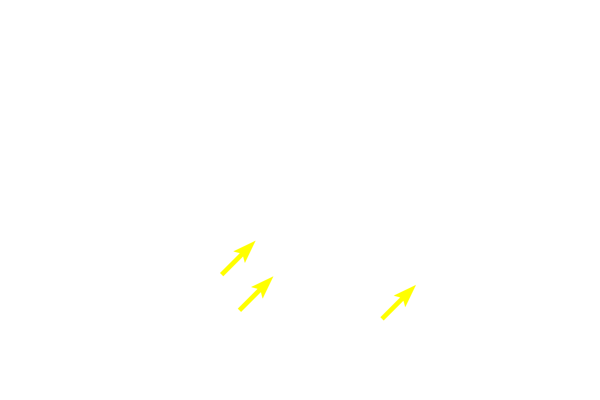  - Enteroendocrine cells > <p>Enteroendocrine cells are also found in the intestinal glands.  Because these cells are secreting into the lamina propria, their granules face the basement membrane of the gland rather than the lumen.</p>
