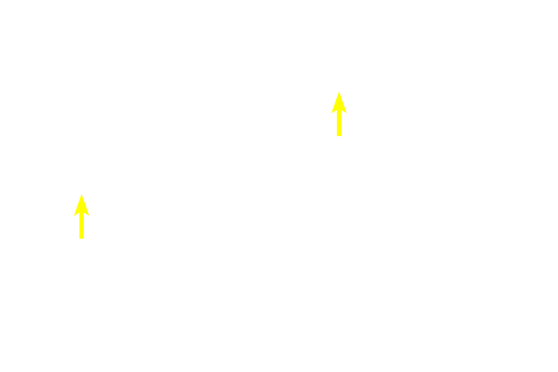 Plasma cells in the lamina propria > <p>The lamina propria of loose connective tissue surrounds the intestinal glands and possesses a wide variety of cells, such as the immunoresponsive plasma cell seen here.</p>
