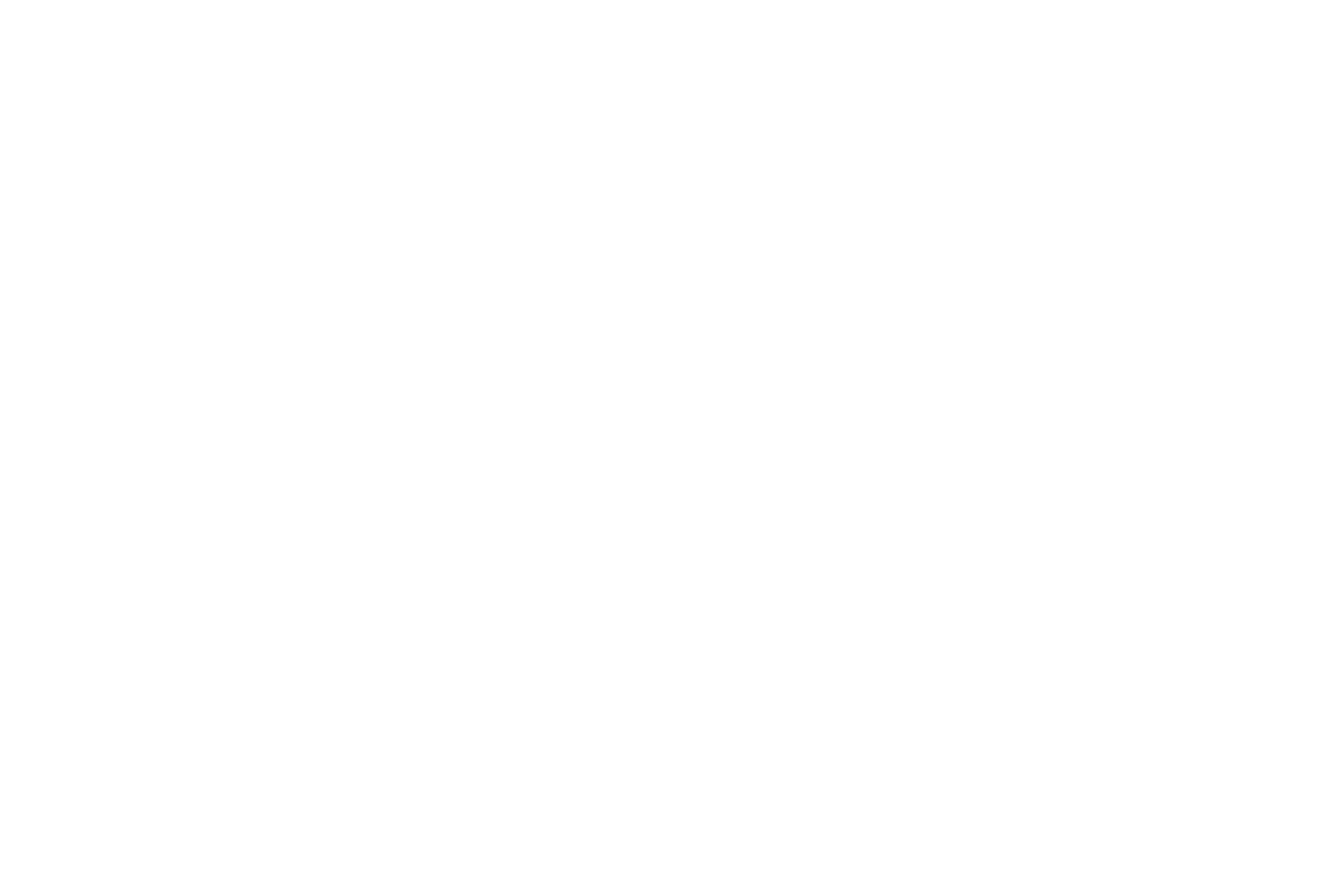 Pyloric region <p>The three regions of the stomach can be distinguished by the ratio of the length of the gastric pits to the length of the gastric glands. In the cardiac region (left), pits and glands are roughly equal in length; in the body and fundic regions (middle), the pits are much shorter than the glands; in the pyloric region, the pits are longer than the glands (right). 100x</p>
