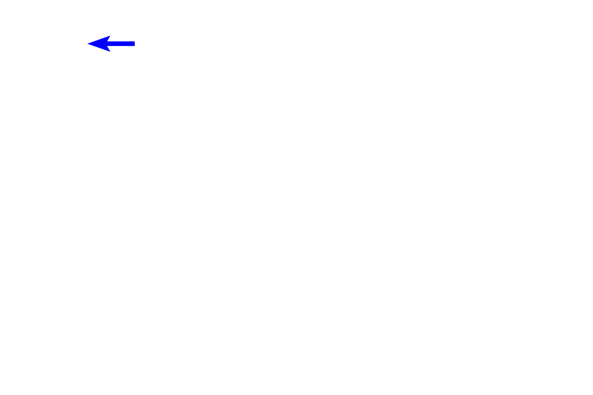 Lumen of gland <p>This image of fundic glands demonstrates the cells of the glands, as well as the adjacent lamina propria and muscularis mucosae.  1000x</p>
