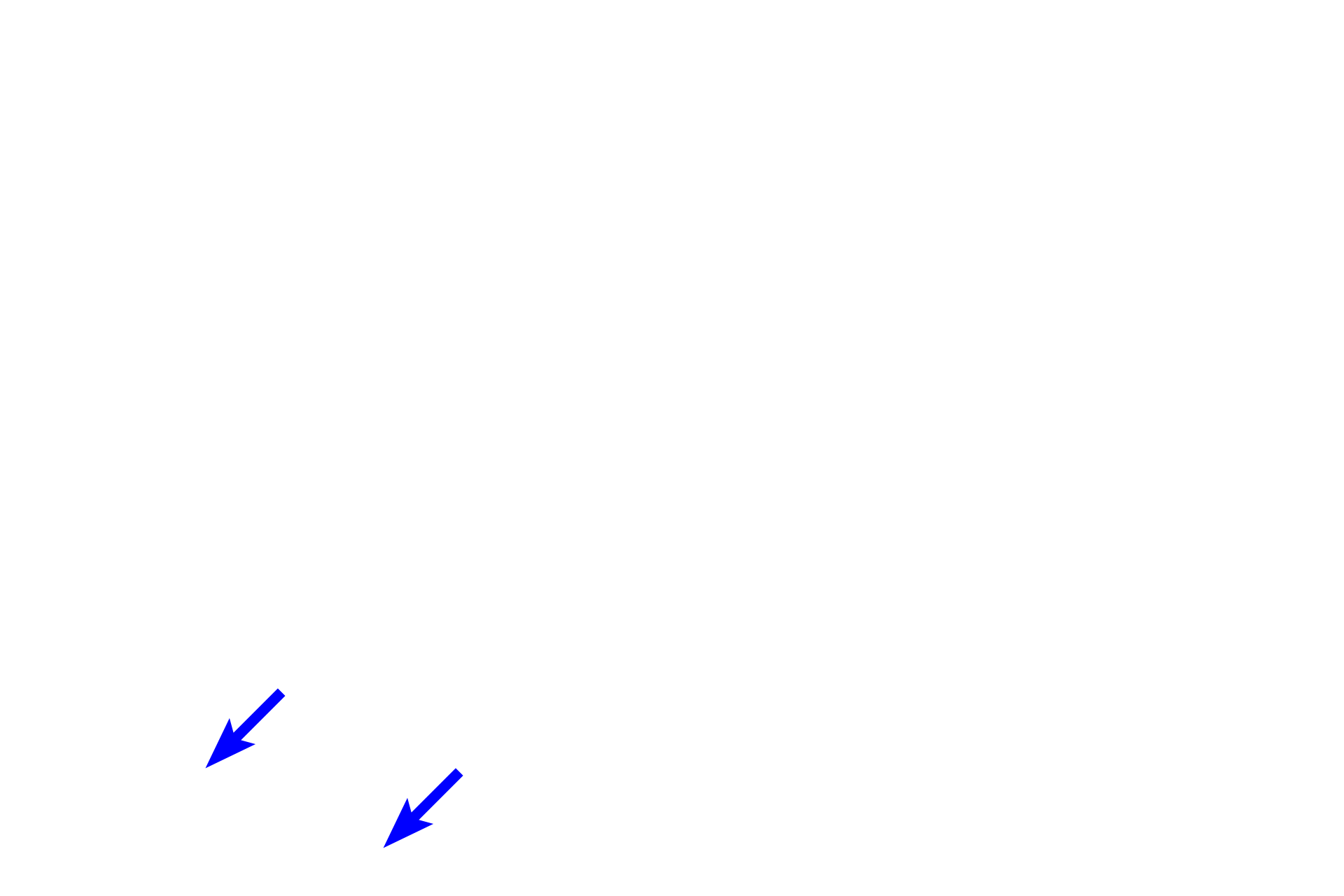 Muscularis mucosae <p>This image of fundic glands demonstrates the cells of the glands, as well as the adjacent lamina propria and muscularis mucosae.  1000x</p>
