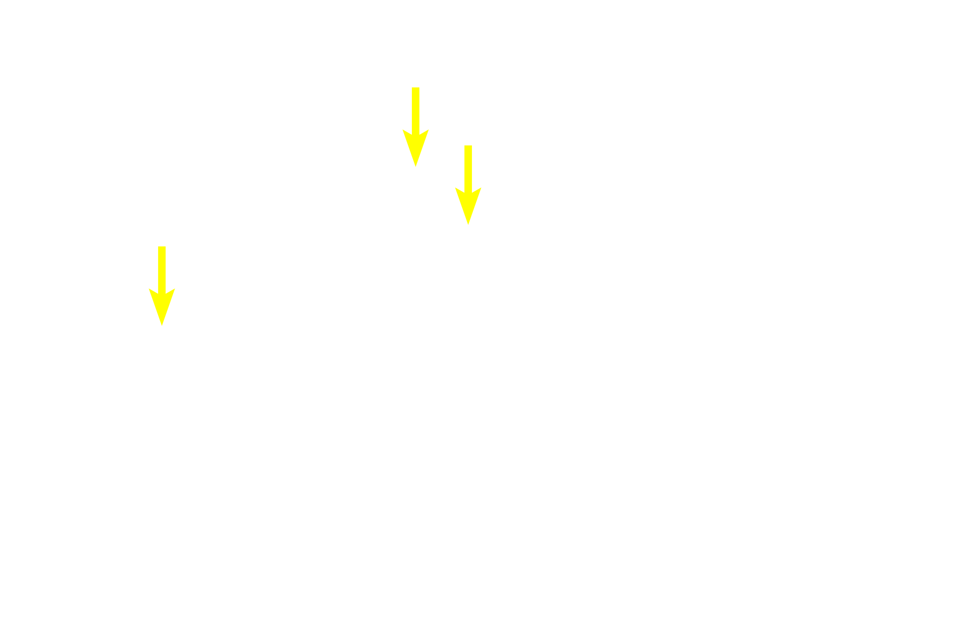 Lumens of glands <p>Bases of gastric glands in the fundic region of the stomach demonstrate several cell types.  1000x</p>
