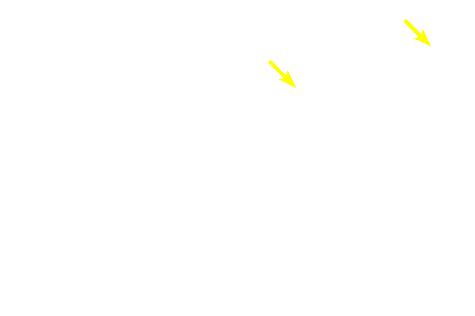 Lymph capillaries <p>Tissue fluid percolating through lamina propria accumulates as lymph in blind-ending lymph capillaries, which anastomose to form larger lymph vessels.  Any antigen not inactivated by lymphoid tissue in the lamina propria would also be transported with tissue fluid into lymph vessels and carried to lymph nodes, the middle defense structures.  600x, 400x</p>
