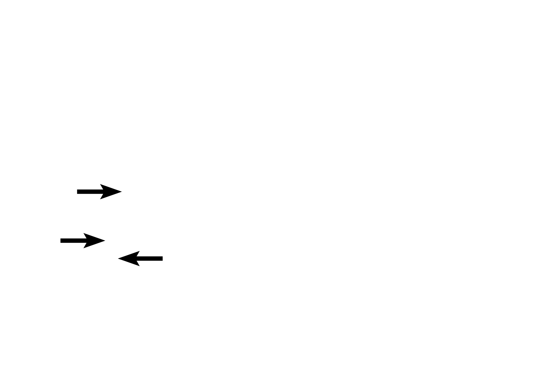 Lymph nodes <p>Tissue fluid percolating through lamina propria accumulates as lymph in blind-ending lymph capillaries, which anastomose to form larger lymph vessels.  Any antigen not inactivated by lymphoid tissue in the lamina propria would also be transported with tissue fluid into lymph vessels and carried to lymph nodes, the middle defense structures.  600x, 400x</p>
