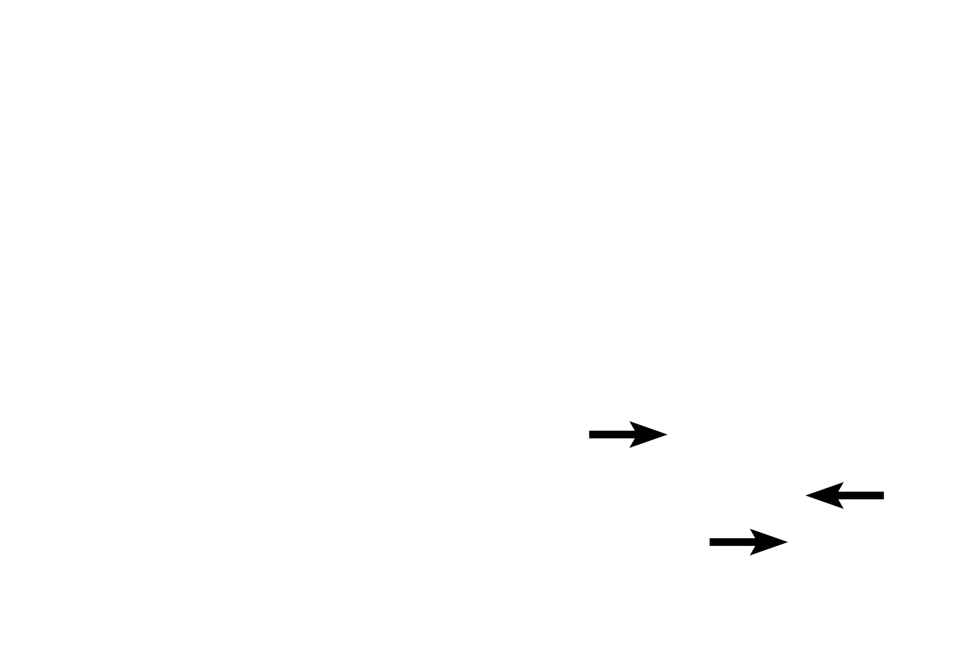 Valves <p>Tissue fluid percolating through lamina propria accumulates as lymph in blind-ending lymph capillaries, which anastomose to form larger lymph vessels.  Any antigen not inactivated by lymphoid tissue in the lamina propria would also be transported with tissue fluid into lymph vessels and carried to lymph nodes, the middle defense structures.  600x, 400x</p>
