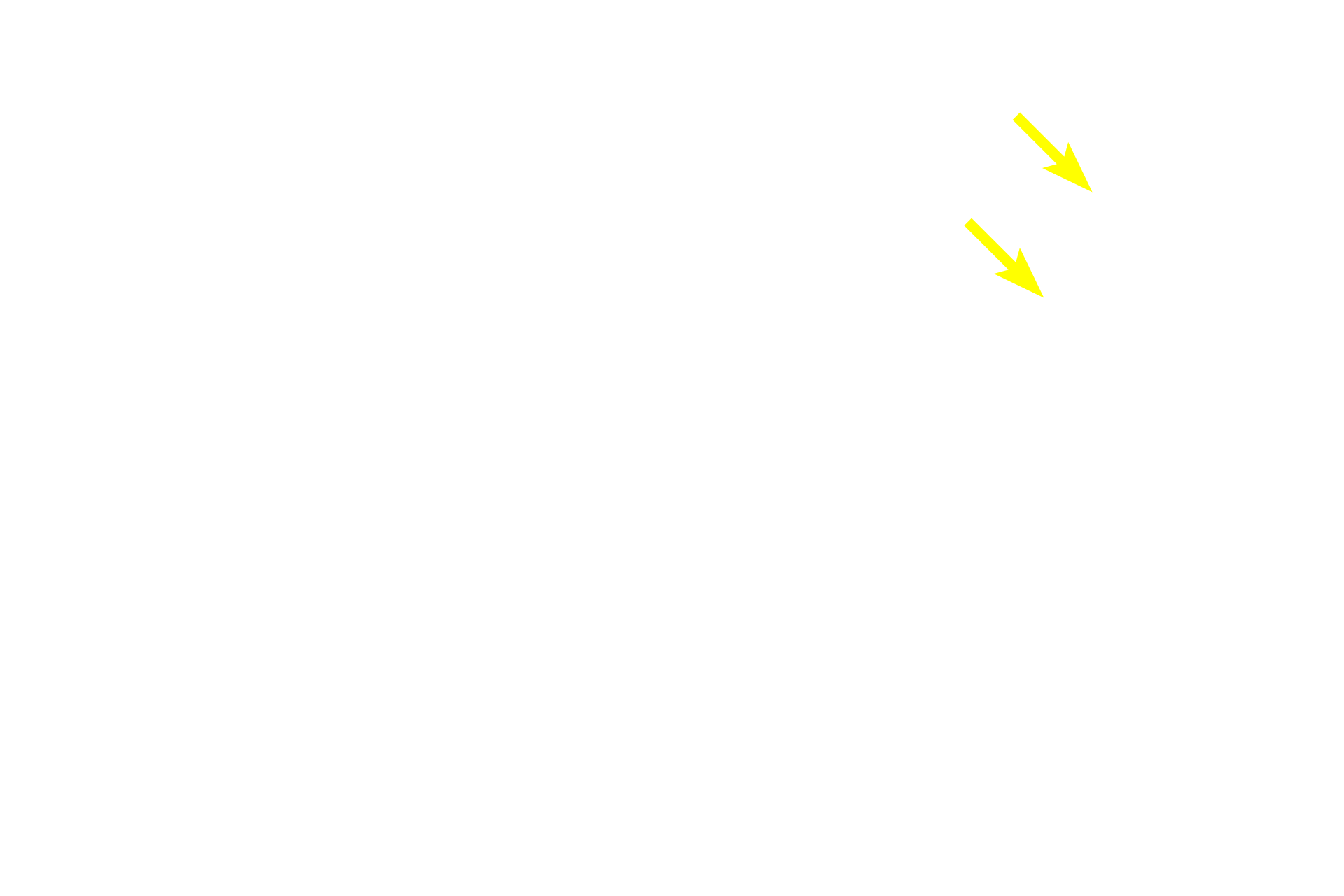 Venule <p>Tissue fluid percolating through lamina propria accumulates as lymph in blind-ending lymph capillaries, which anastomose to form larger lymph vessels.  Any antigen not inactivated by lymphoid tissue in the lamina propria would also be transported with tissue fluid into lymph vessels and carried to lymph nodes, the middle defense structures.  600x, 400x</p>
