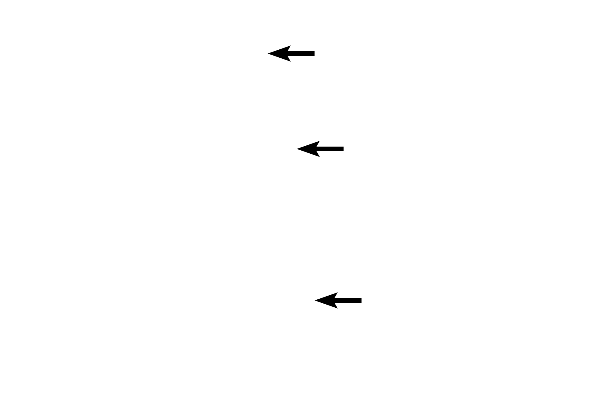 Trabeculum <p>After leaving the white pulp, a central arteriole subdivides to form smaller arterioles and capillaries that eventually supply splenic sinuses in red pulp.  The capillaries may open directly into the splenic sinuses (closed circulation) or indirectly by opening into splenic cords (open circulation).  In the human an open circulation is thought to predominate.  100x</p>
