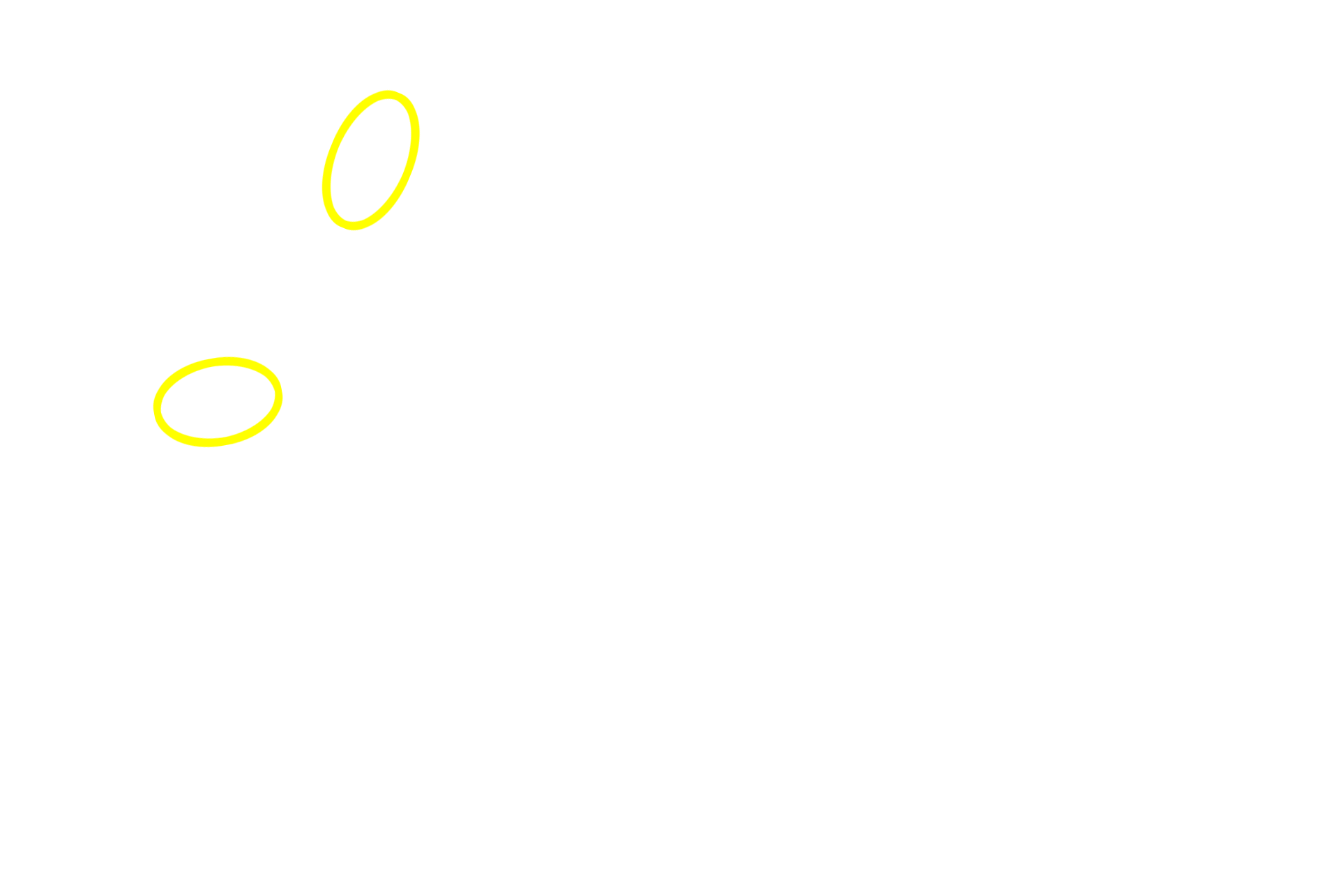 Periarterial lymphoid sheath (PALS) <p>After leaving the white pulp, a central arteriole subdivides to form smaller arterioles and capillaries that eventually supply splenic sinuses in red pulp.  The capillaries may open directly into the splenic sinuses (closed circulation) or indirectly by opening into splenic cords (open circulation).  In the human an open circulation is thought to predominate.  100x</p>
