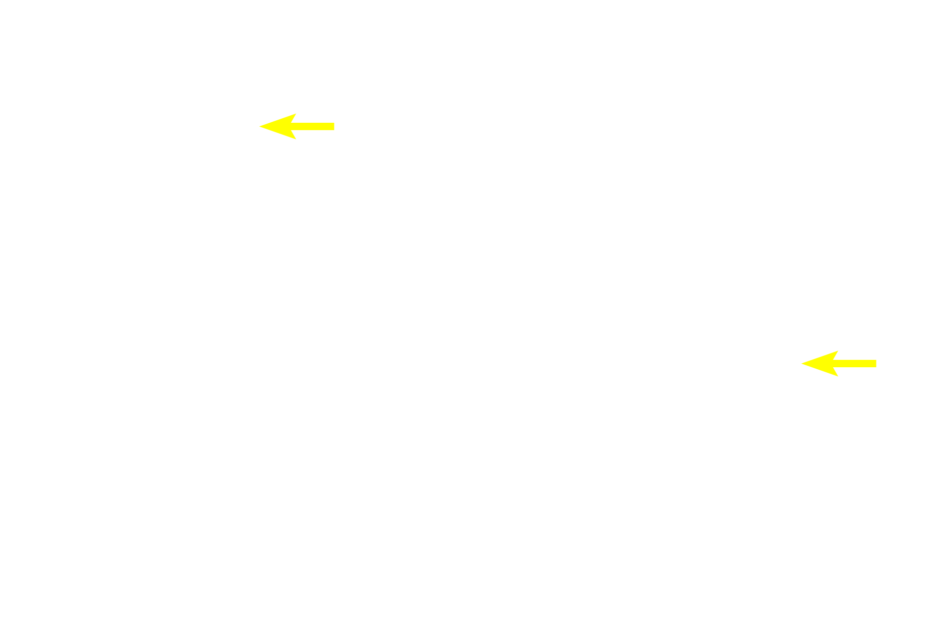 Central arterioles <p>After leaving the white pulp, a central arteriole subdivides to form smaller arterioles and capillaries that eventually supply splenic sinuses in red pulp.  The capillaries may open directly into the splenic sinuses (closed circulation) or indirectly by opening into splenic cords (open circulation).  In the human an open circulation is thought to predominate.  100x</p>
