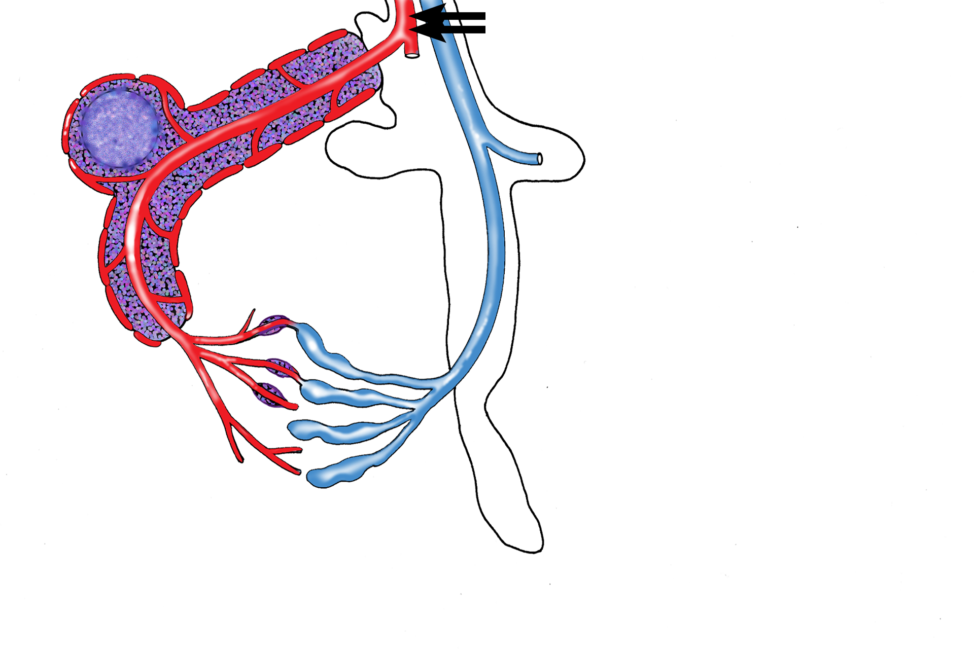 Trabecular artery > <p>The splenic artery enters the spleen and subdivides into branches that enter trabeculae, called trabecular arteries.</p>
