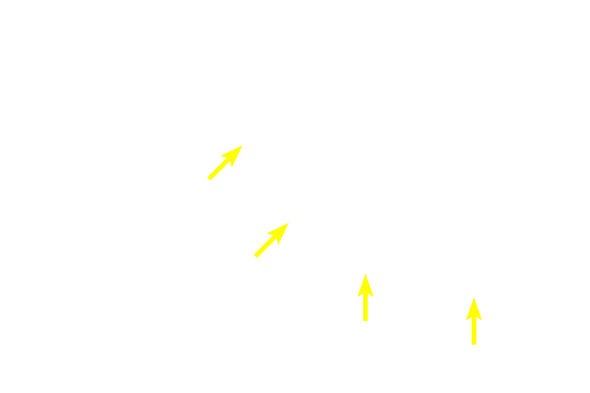 Central arteriole <p>The central arteriole and its relationship to the PALS is seen at higher magnification (area indicated by the yellow frame in the inset).  For most of its course, the central arteriole is surrounded by PALS.  Frequently, lymphoid nodules, B-dependent areas that form part of white pulp, develop within the PALS, causing the central arteriole to be eccentrically located.  A germinal center is just beginning to form.  200x</p>

