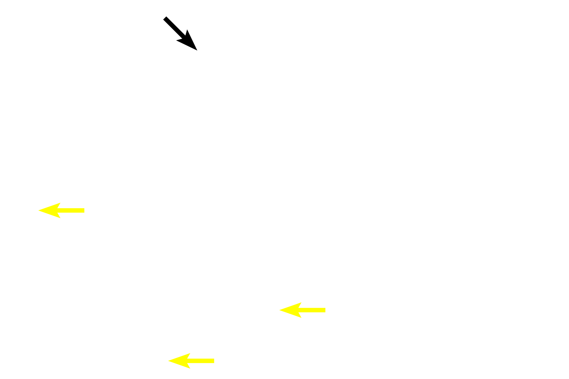 Blood vessels <p>The cortex is composed primarily of closely packed, immature T lymphocytes (thymocytes), supported by a framework of epithelial reticular cells.  A few macrophages are also present.  A thin connective tissue capsule surrounds the thymus; blood vessels enter the thymus through the capsule and its septa.  400x</p>
