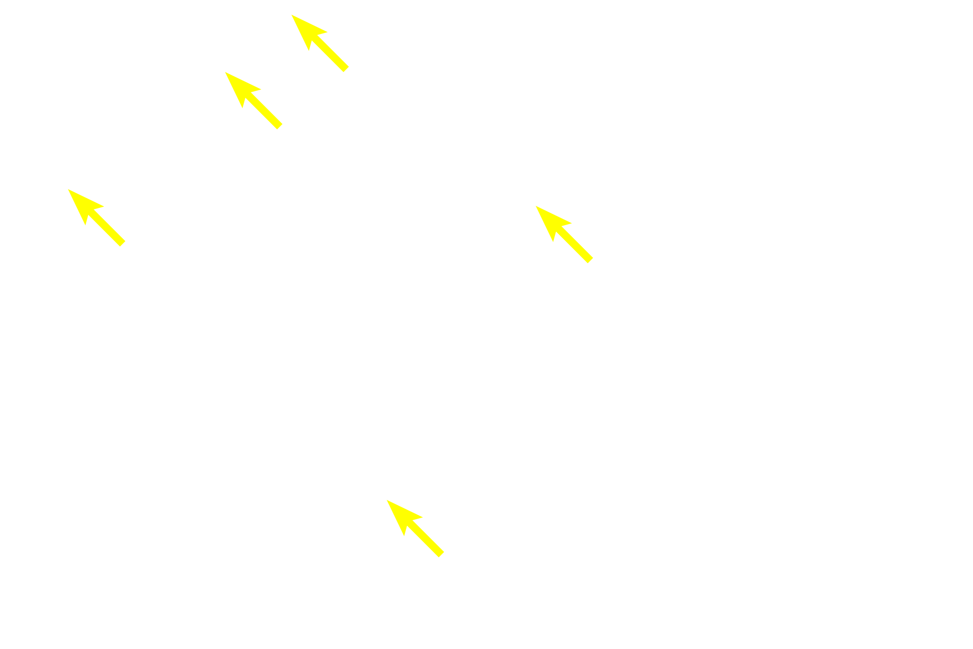 Lymphoblasts > <p>Lymphoblasts have spherical nuclei that are larger than those of the thymocytes they form.  Lymphoblasts are derived from the bone marrow and migrate into the thymus to form T lymphocytes.</p>
