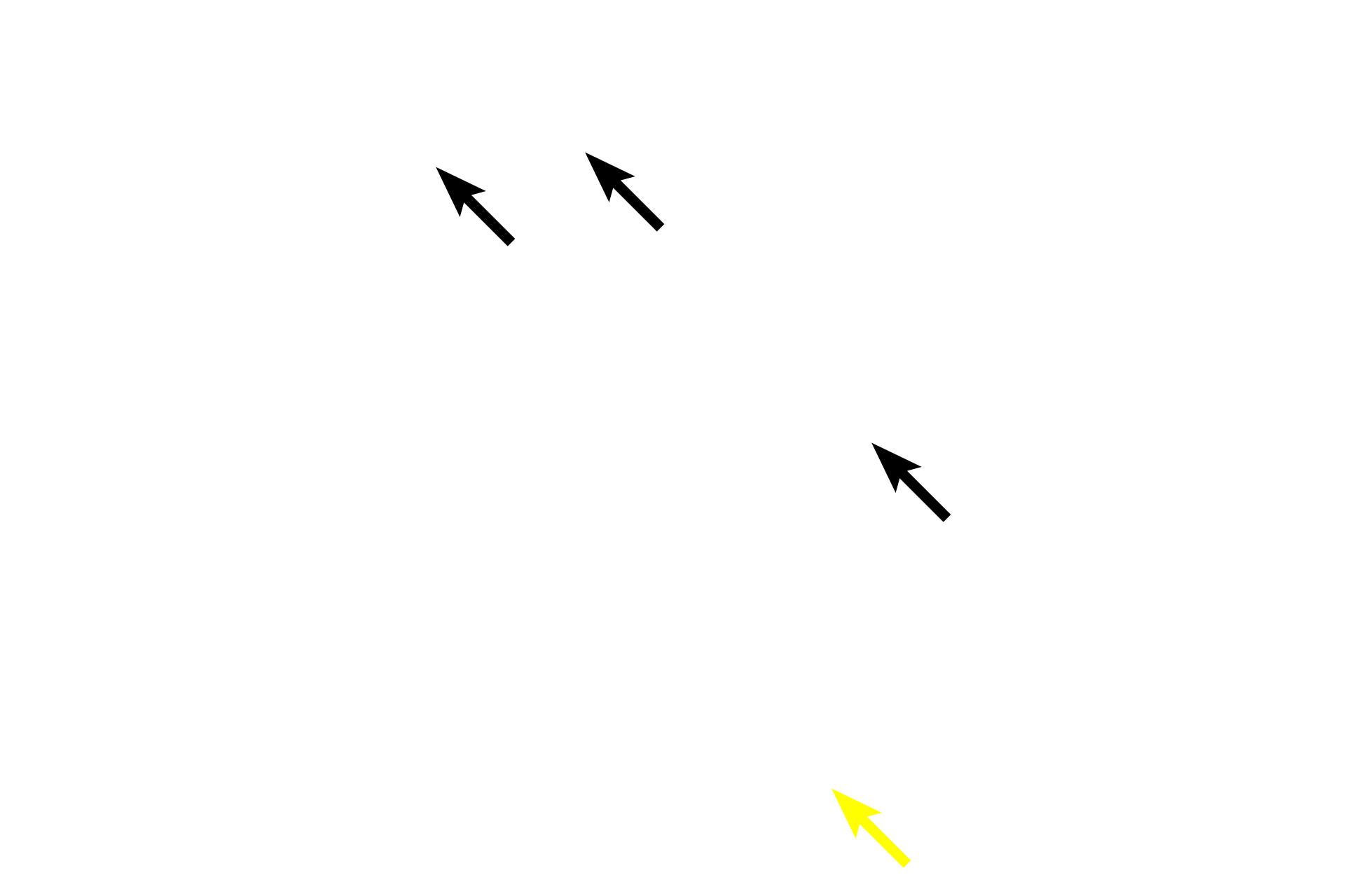 Goblet cells > <p>Unicellular glands, such as goblet cells, are usually located in simple epithelia.  The conjunctiva represents a unique case in which these glands are part of a stratified epithelium.</p>
