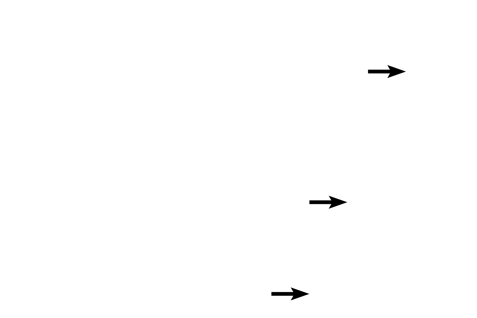 Descemet's membrane > <p>Descemet’s membrane is a thick, homogeneous, basal lamina produced by the corneal endothelial cells.</p>
