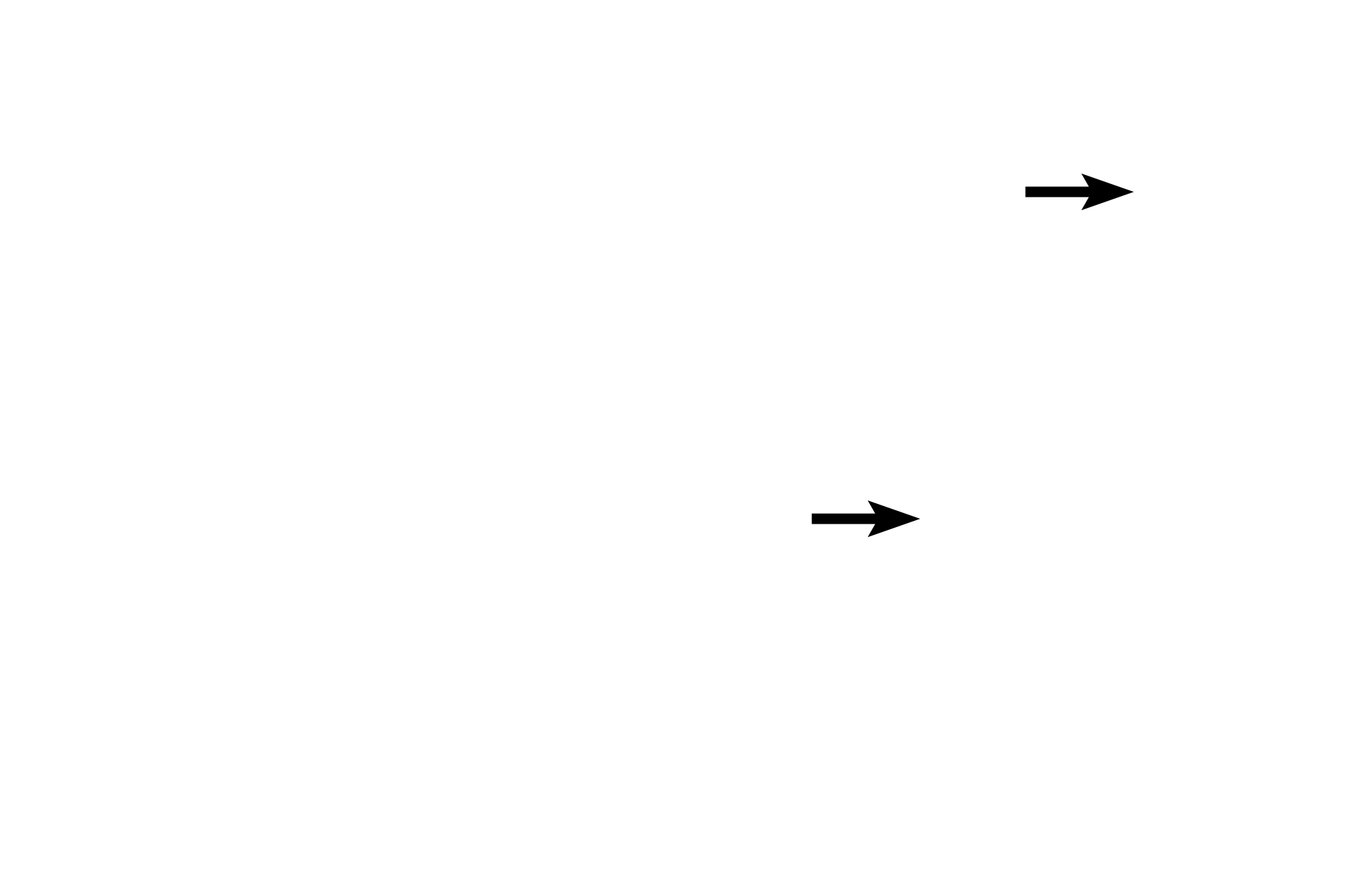 Descemet's membrane > <p>Descemet’s membrane is a thick, homogeneous basal lamina produced by the endothelial cells.  In this preparation, Descemet’s membrane is clearly visible..</p>
