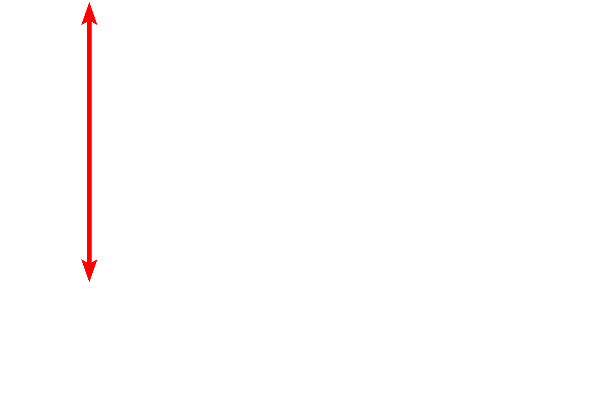 Iris <p>The lens is a critical refractive element of the eye located immediately behind the iris.  The lens is a biconvex, transparent, crystalline structure held in place by the zonule fibers (not seen here) from the ciliary body.  The high elasticity of the lens is lost with age, resulting in a decreased ability to adjust for distinct vision at different distances (accommodation).  The lens is avascular, nourished by aqueous and vitreous humors.  200x</p>
