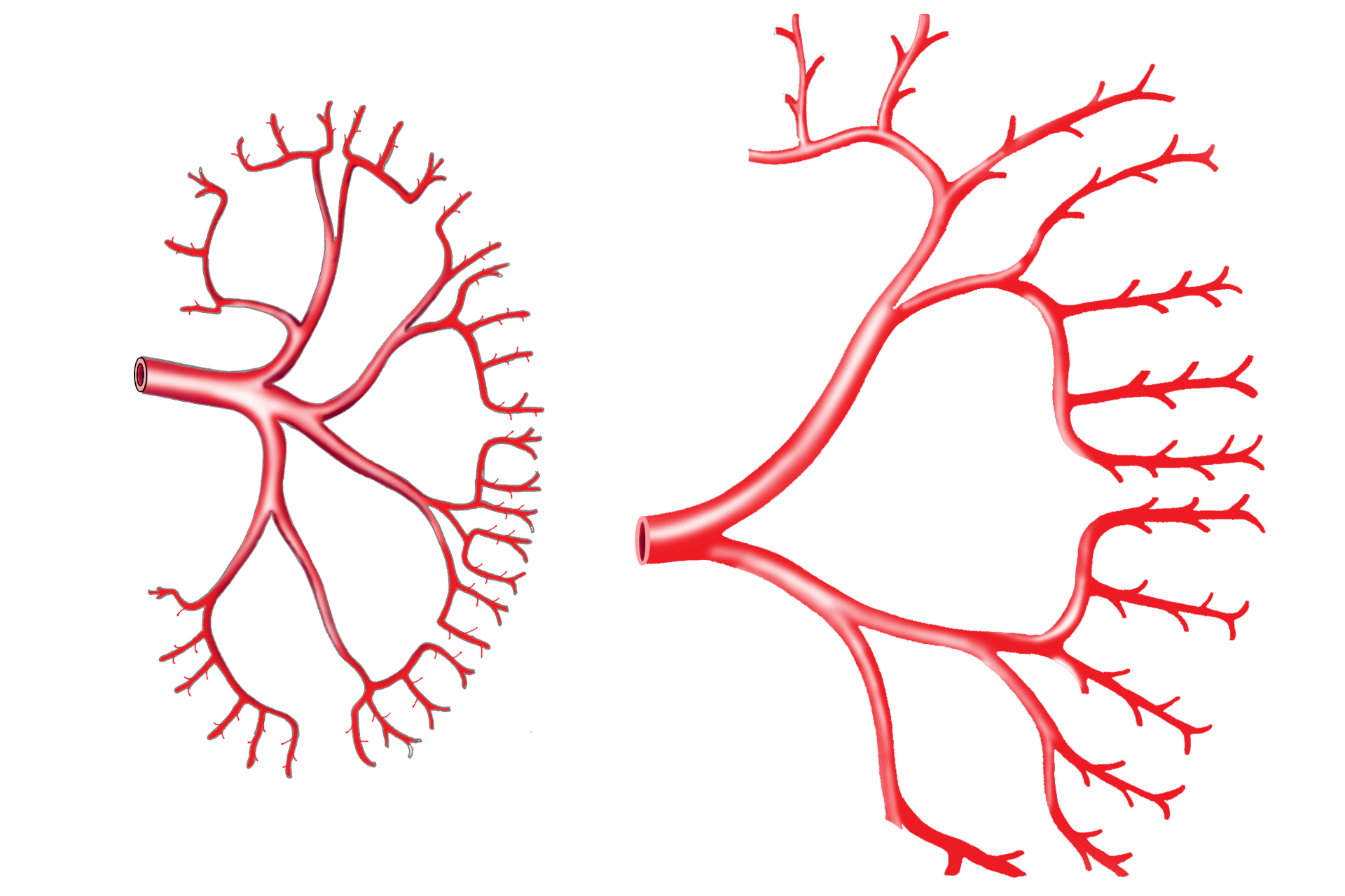 Arterial supply > <p>The arterial supply to the kidney is substantial and complex.  The renal artery, a branch of the abdominal aorta, enters at the hilum of the kidney. The renal artery supplies the interlobar, arcuate and interlobular arteries, in that order.</p>
