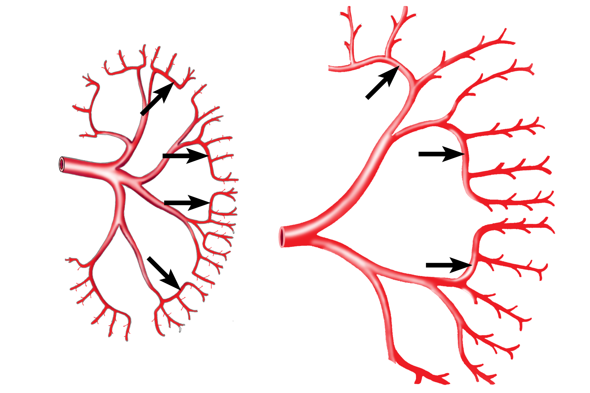  - Arcuate artery <p>When the renal artery enters the kidney, it branches into interlobar arteries, which travel between the pyramids through the renal columns. These arteries branch laterally to form the arcuate vessels that mark the boundary between cortex and medulla. Interlobular arteries leave the arcuates to enter the convoluted portions of the cortex.</p>

