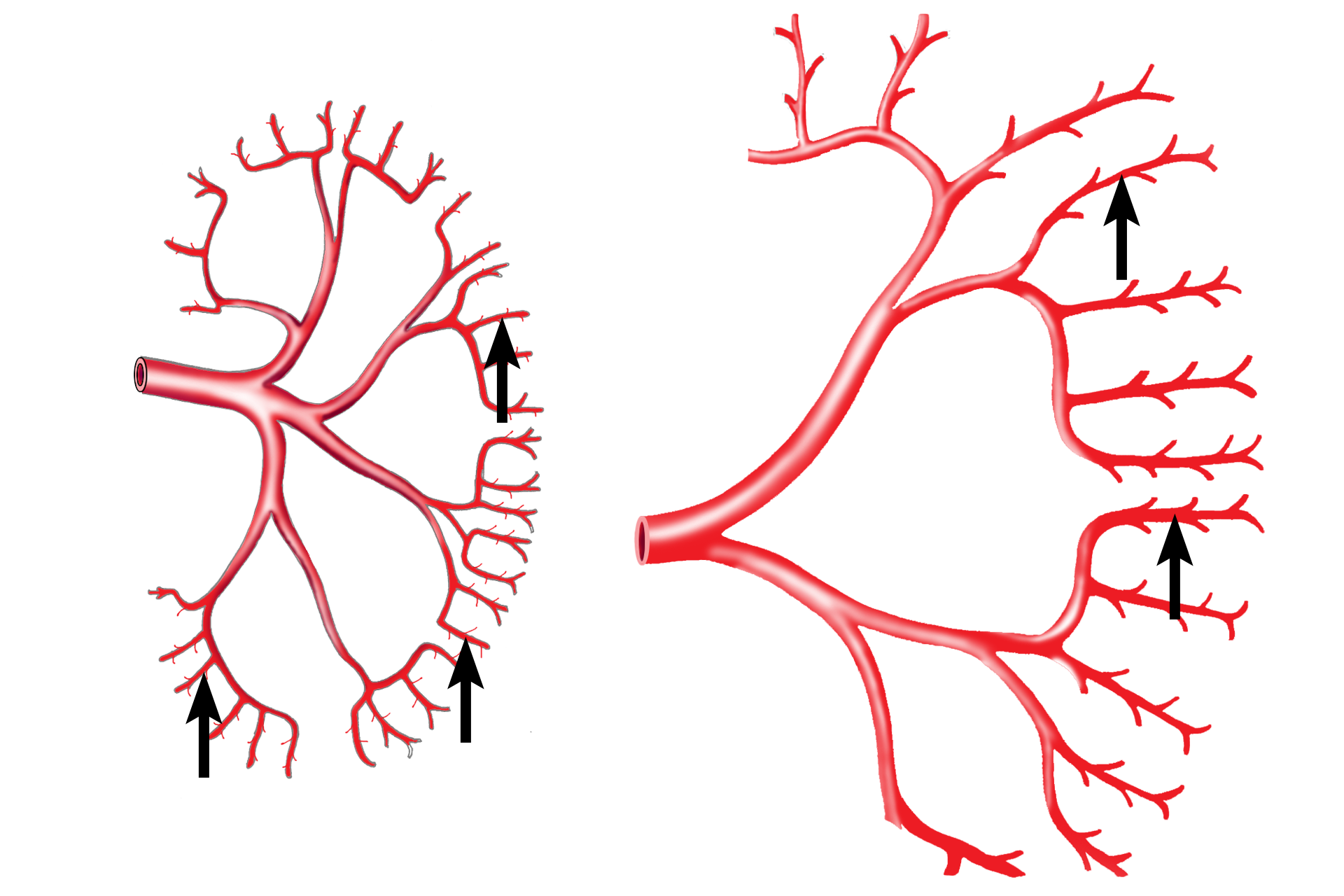  - Interlobular artery <p>When the renal artery enters the kidney, it branches into interlobar arteries, which travel between the pyramids through the renal columns. These arteries branch laterally to form the arcuate vessels that mark the boundary between cortex and medulla. Interlobular arteries leave the arcuates to enter the convoluted portions of the cortex.</p>

