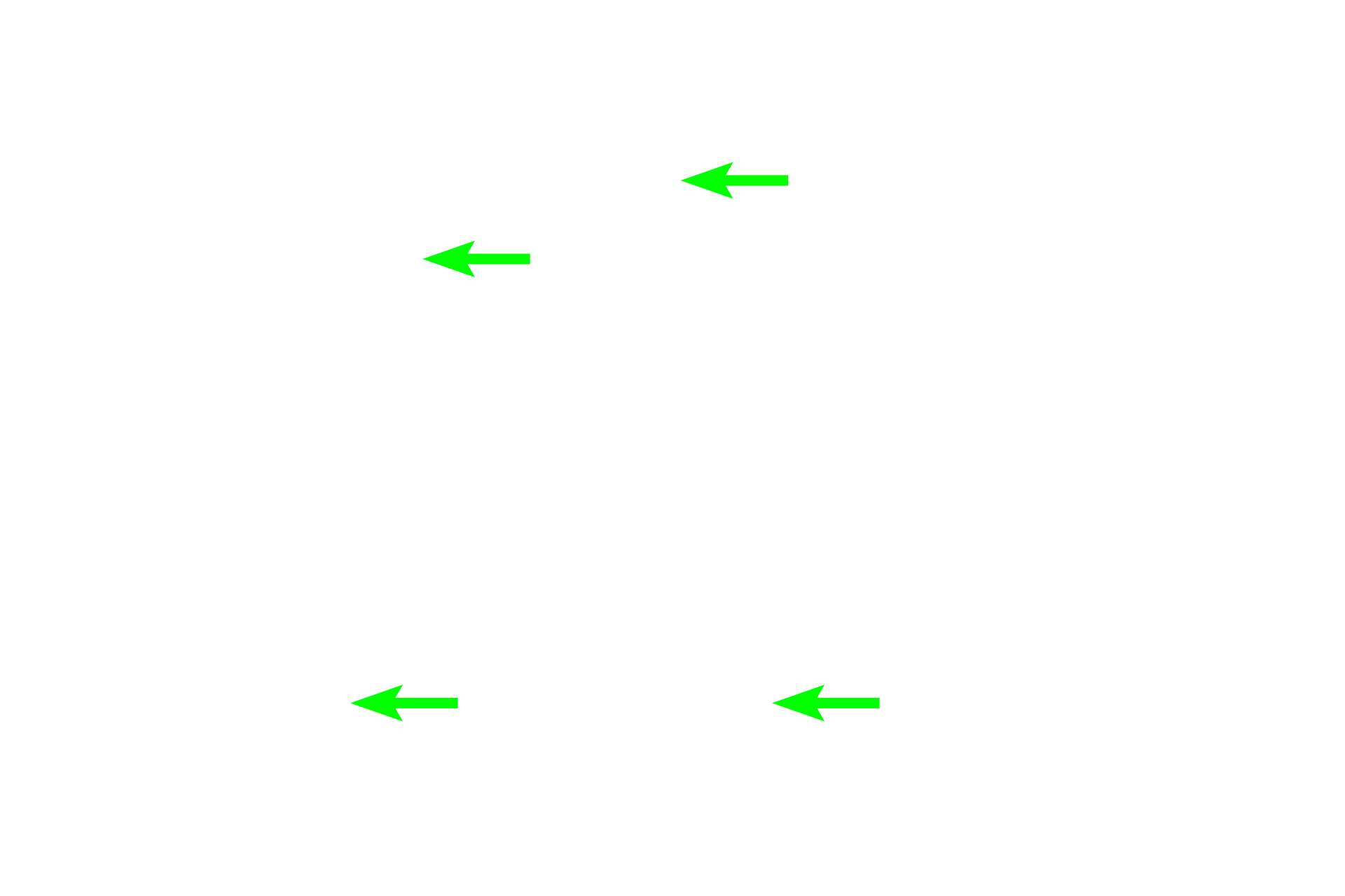 Connecting tubules > <p>Connecting tubules are lined by a simple cuboidal epithelium whose nuclei are evenly spaced around the tubule.  Connecting tubules connect the distal convoluted tubule with the collecting duct in the medullary ray.</p>
