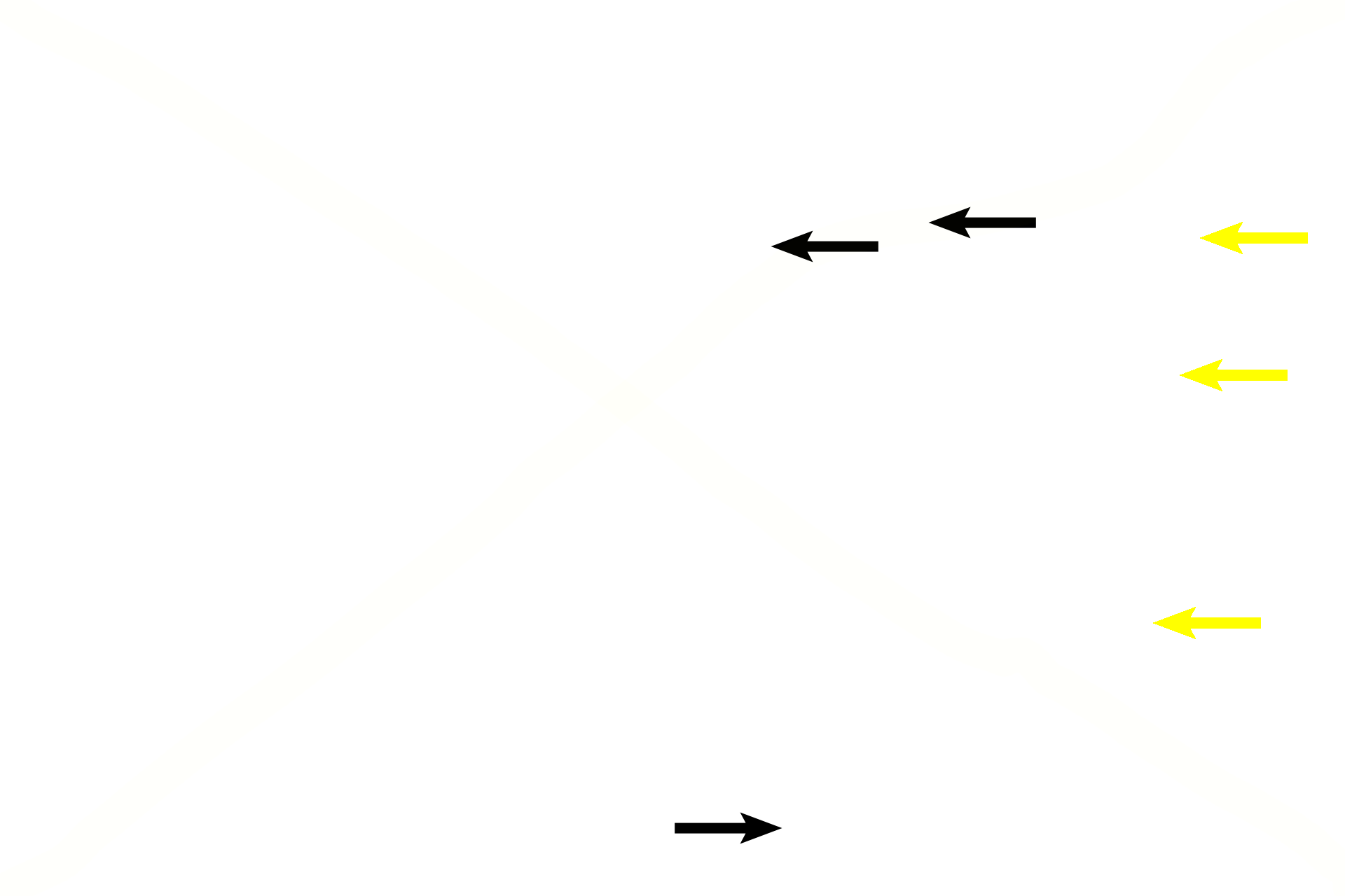 Endosteum > <p>An endosteum lines all interior bony surfaces. The cells in this layer are readily visible in the bony interior (black arrows), but are difficult to differentiate at the marrow surface (yellow arrows) from the cells of the adjacent red marrow to the right.</p>
