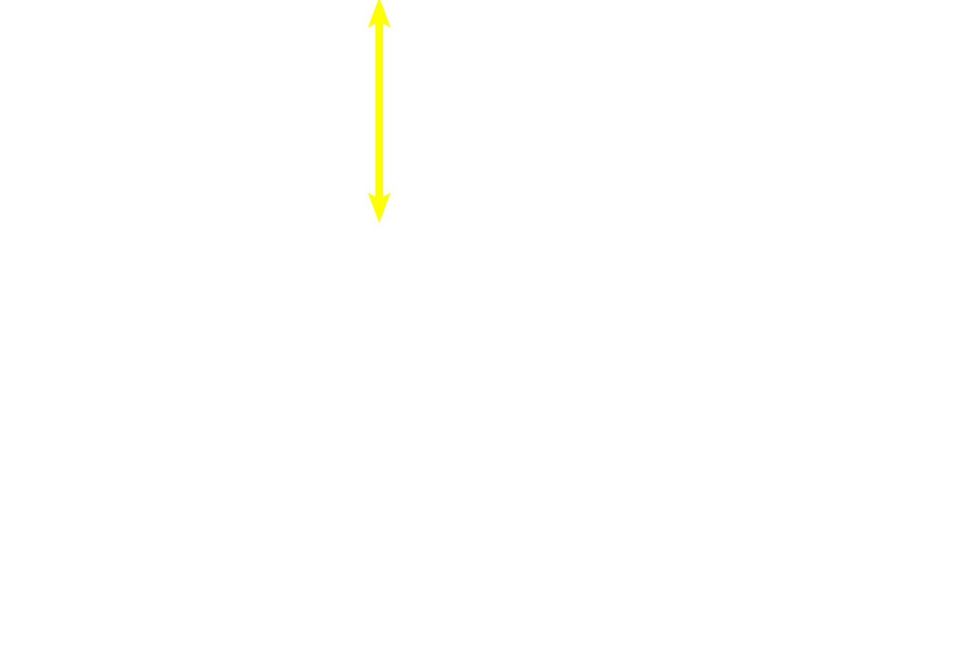 Hyaline cartilage > <p>Typical hyaline cartilage fills the epiphysis at the upper portion of the image.</p>
