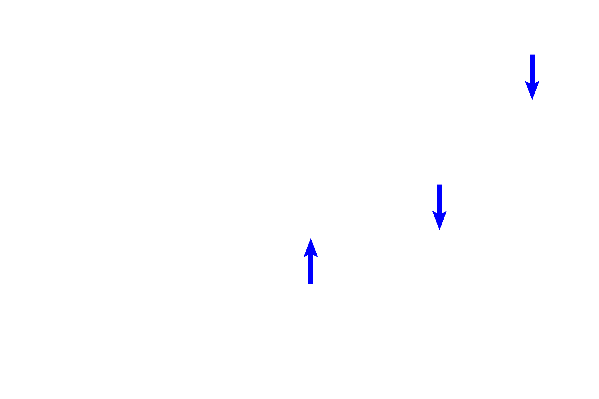 Right image > <p>The right image is quite similar to that on the left with the exception that several osteoclasts (arrows) are present in the endosteum surrounding the spicules of calcified cartilage plus bone. The presence of these cells indicates that this must be the zone of resorption.</p>
