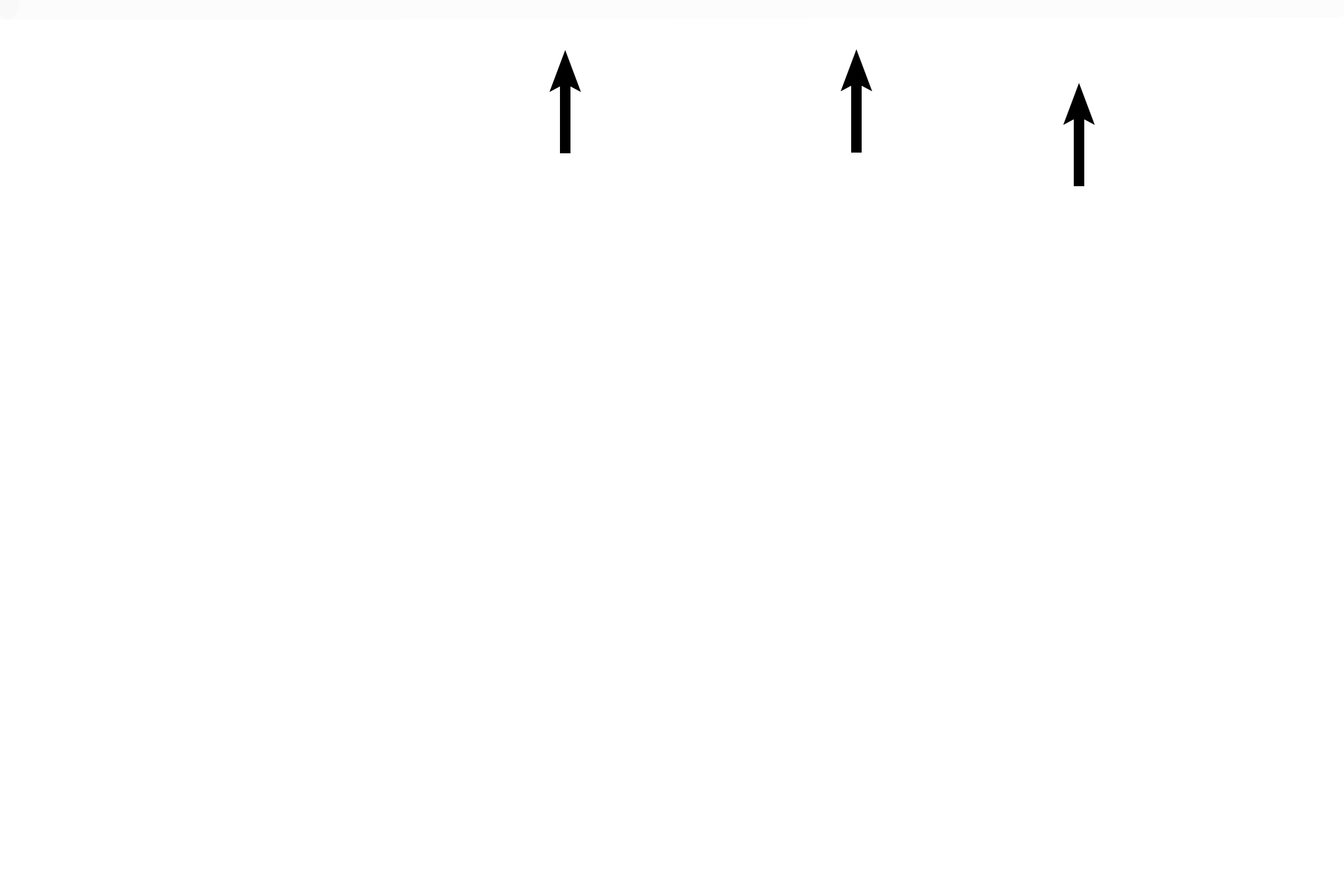 Outer table <p>Flat bones of the skull represent another bone type based on shape. Adult flat bones consist of a diploe of spongy bone sandwiched between inner and outer tables of compact bone. Flat bones originally form in the fetus (lower image) as spongy bone; peripheral regions of this spongy bone are converted to compact bone of the inner and outer tables. 3x, 10x</p>
