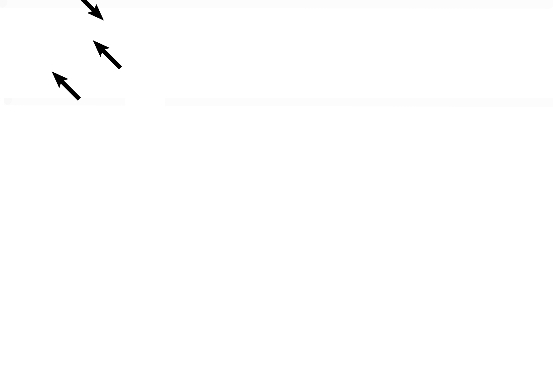 Suture <p>Flat bones of the skull represent another bone type based on shape. Adult flat bones consist of a diploe of spongy bone sandwiched between inner and outer tables of compact bone. Flat bones originally form in the fetus (lower image) as spongy bone; peripheral regions of this spongy bone are converted to compact bone of the inner and outer tables. 3x, 10x</p>
