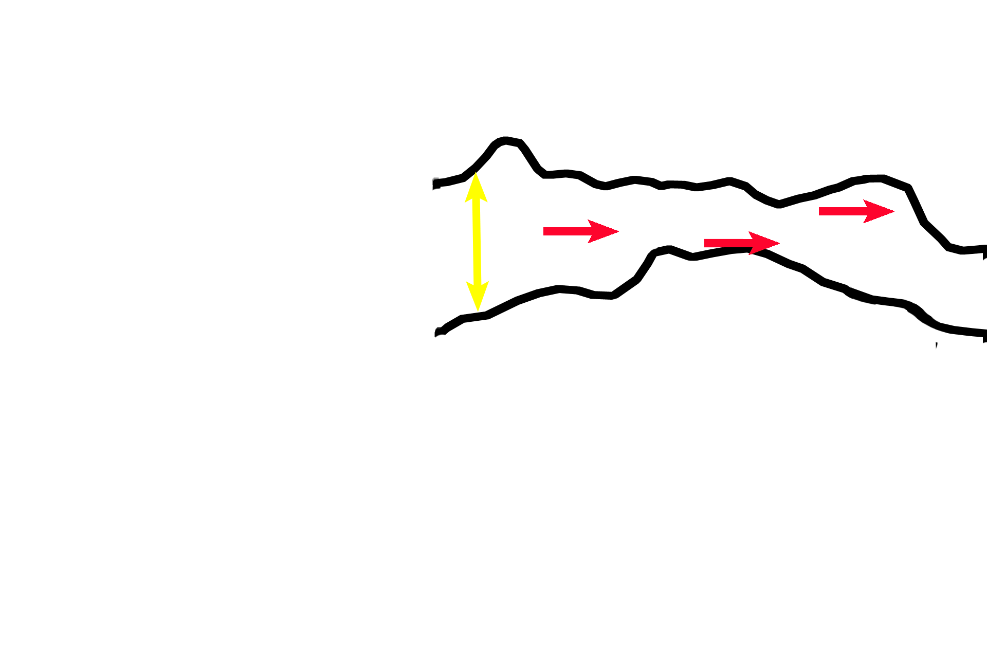 Zone of degeneration > <p>In the zone of degeneration (yellow arrow), chondrocytes have died, leaving behind the calcified cartilage spicules (red arrows) that separated the isogenous groups.</p>
