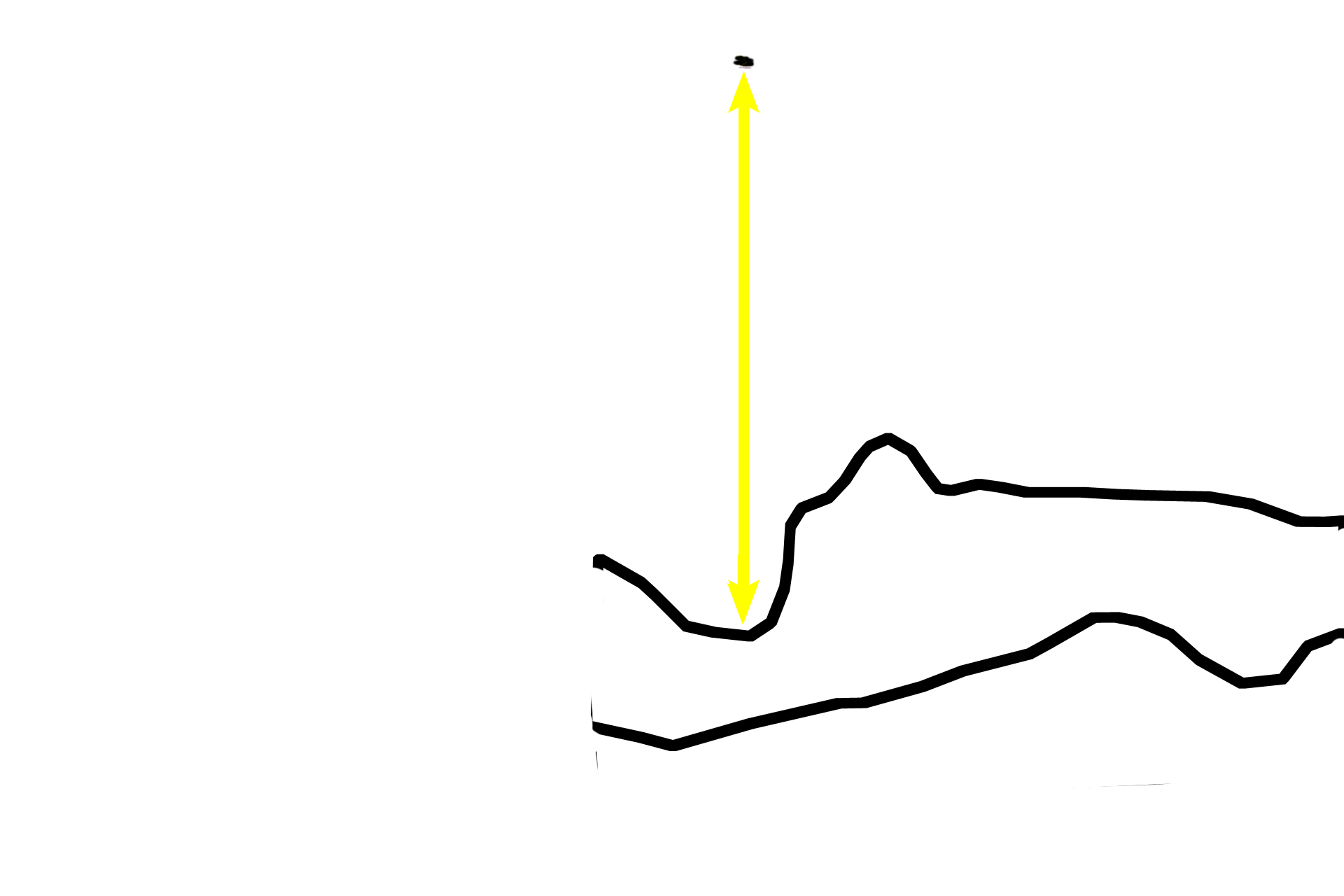 Zones of M-H-C > <p>In the zone of maturation-hypertrophy-calcification (arrow) [M-H-C], chondrocytes begin to mature, hypertrophy and secrete alkaline phosphatase into the matrix. An alkaline environment encourages the calcification of the cartilage matrix, thus prohibiting diffusion of nutrients to the chondrocytes.</p>
