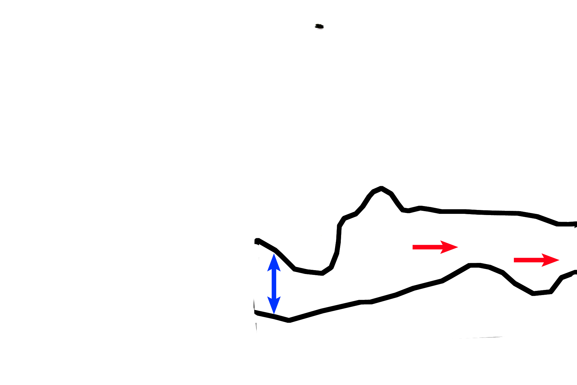 Zone of  degeneration > <p>Having been deprived of nutrients and oxygen, chondrocytes die, leaving behind their empty lacunae. The vertical cylinders of calcified cartilage (like empty tennis ball cans, red arrows) separate the empty lacunae and comprise the zone of degeneration (blue arrow). The cylinders of calcified cartilage appear as linear spicules in sections.</p>
