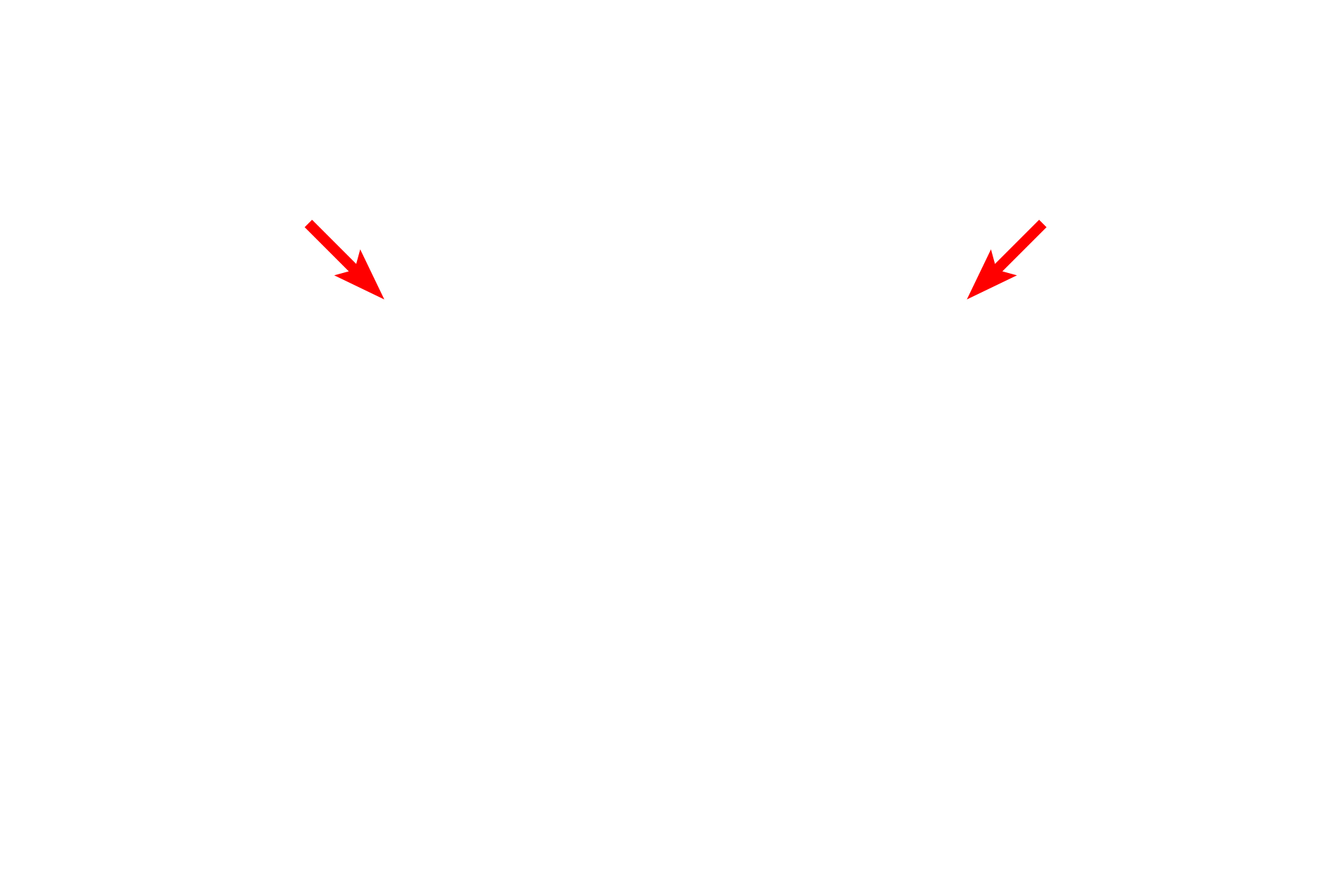 Cutaneous membrane > <p>The cutaneous membrane, or skin, covers the exterior of the body and is composed of a stratified squamous keratinized epithelium, called the epidermis, and a connective tissue layer, the dermis.</p>
