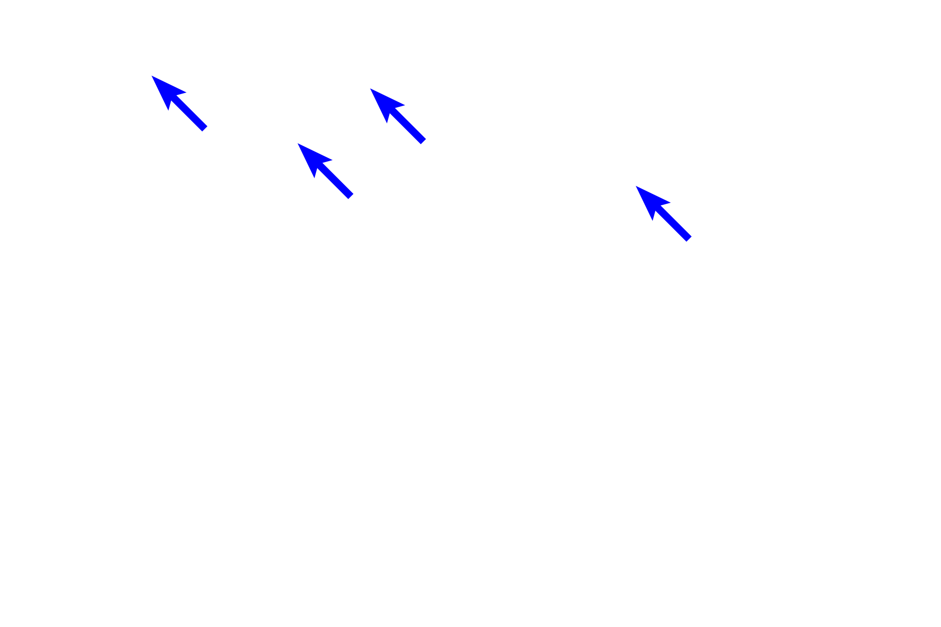 Active fibroblast nuclei > <p>The nucleus of an active fibroblast is oval-shaped and mostly euchromatic. The cytoplasm is difficult to distinguish as it blends with the surrounding collagen fibers. These cells are actively producing the extracellular matrix around them.</p>
