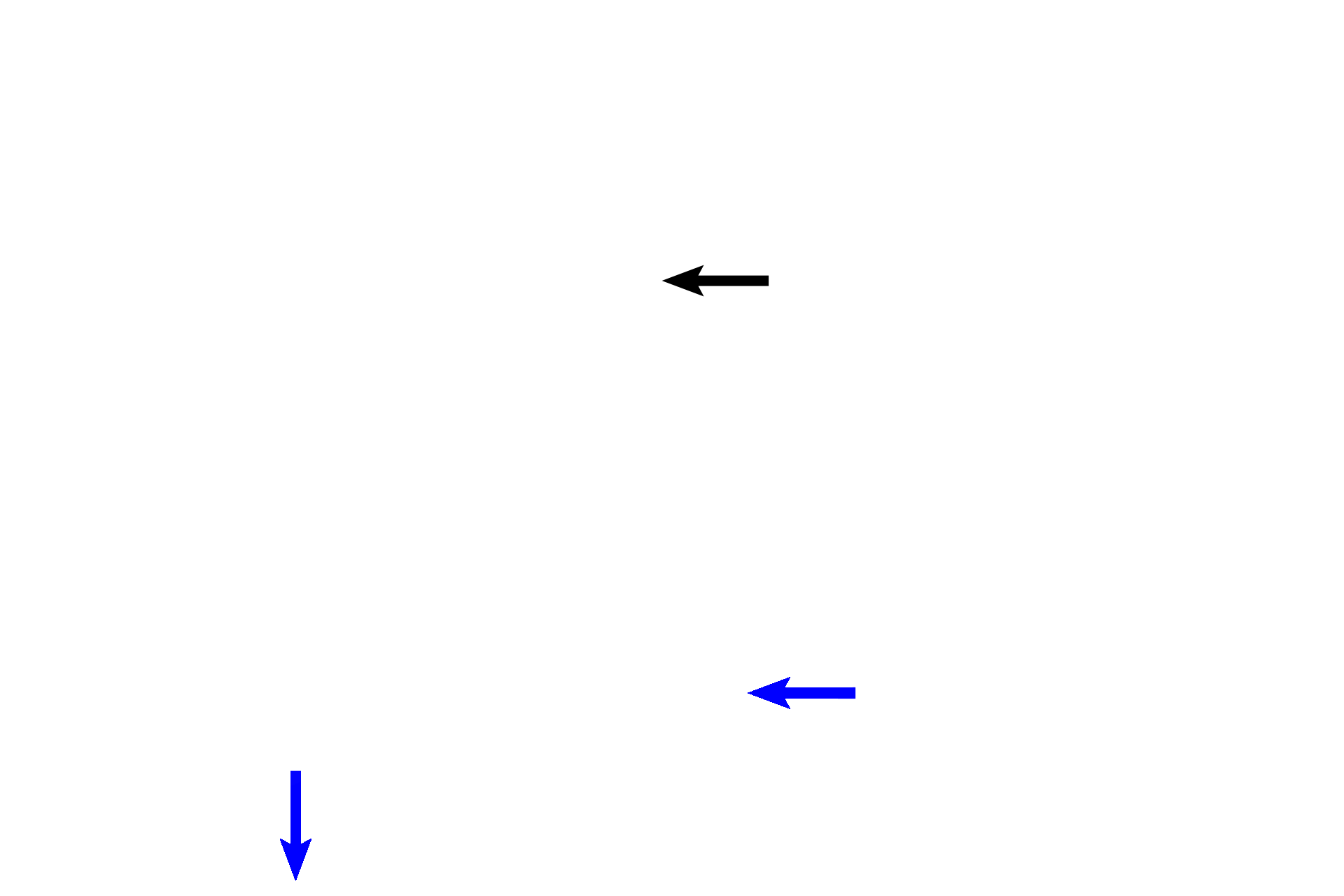 Cartilage / bone > <p>Cartilage (black arrow) forms the framework for the septum at this stage of fetal development.  Bone (blue arrows) is already being deposited along the inferior border of the septum and will replace the cartilage over time. </p>
